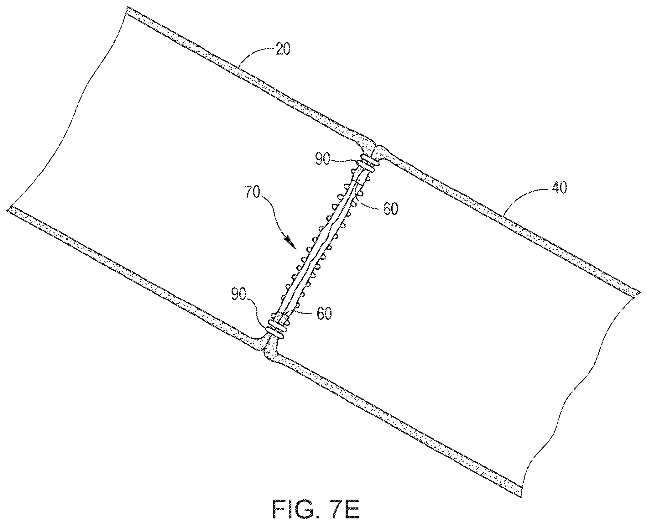 Patent US12508029 Figure 10 – Method for calibrating movements of actuated members of powered surgical stapler