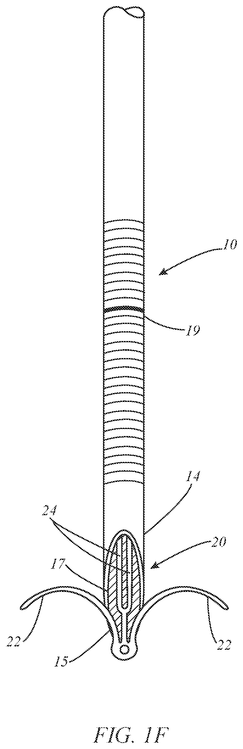 Patent US12508030 Figure 3 – Apparatus and methods for closing vessels