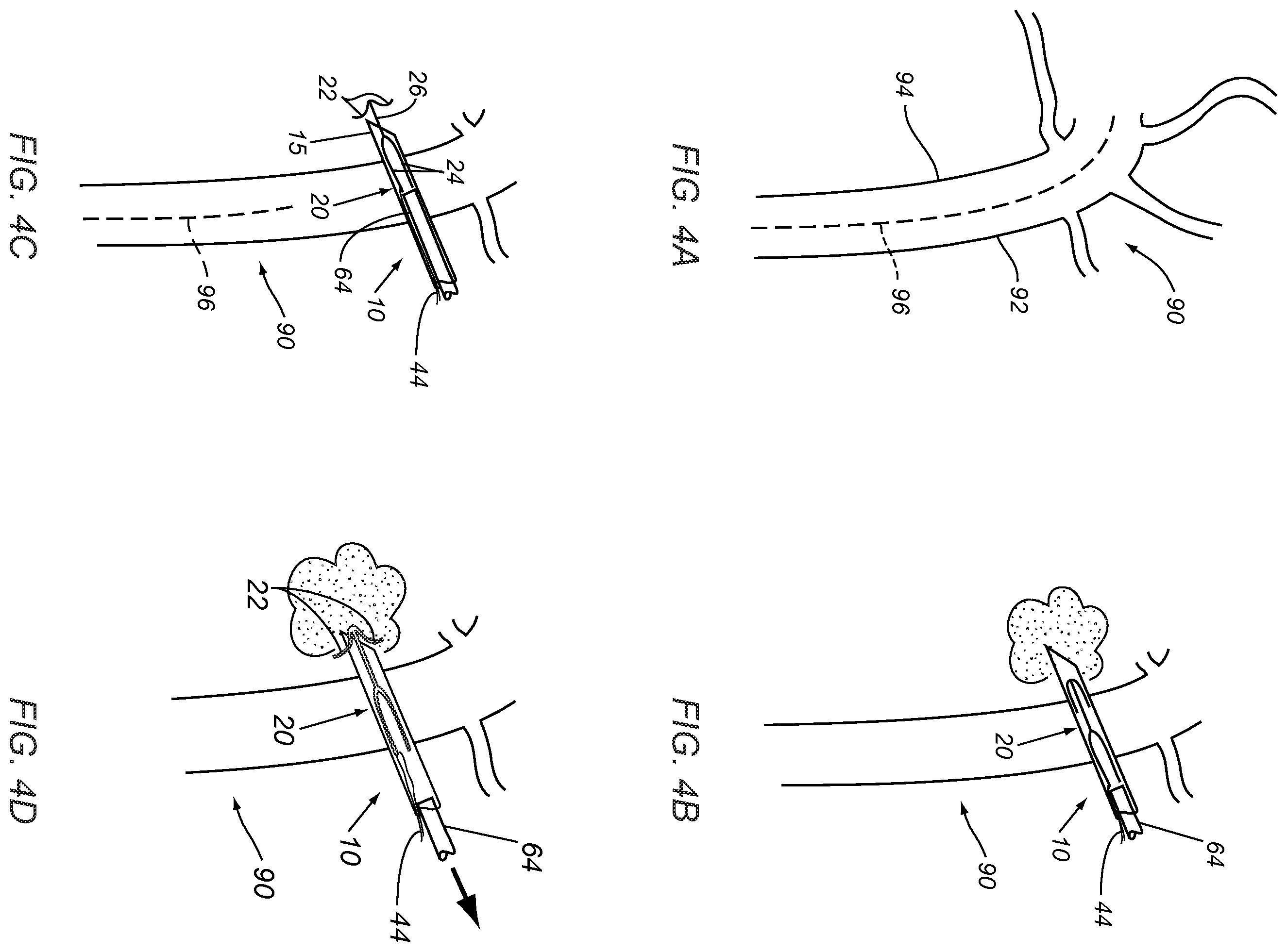 Patent US12508030 Figure 6 – Apparatus and methods for closing vessels