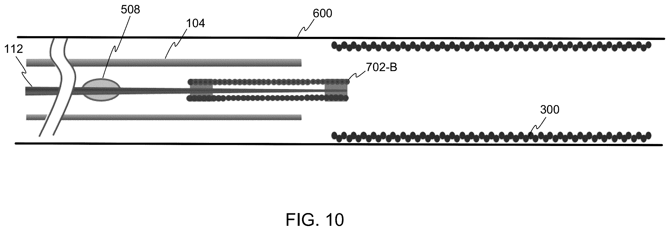 Patent US12508031 Figure 7 – Neurovascular flow diverter and delivery systems