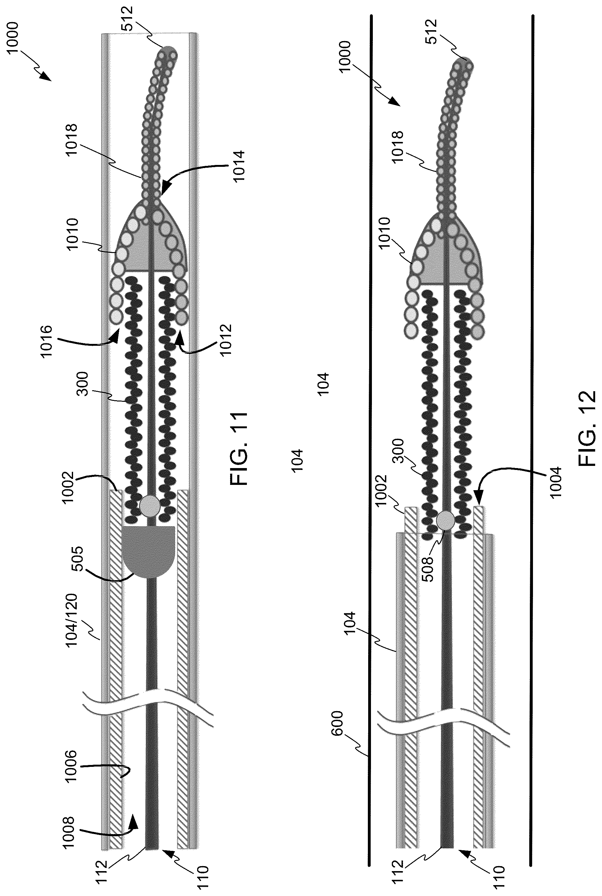 Patent US12508031 Figure 8 – Neurovascular flow diverter and delivery systems