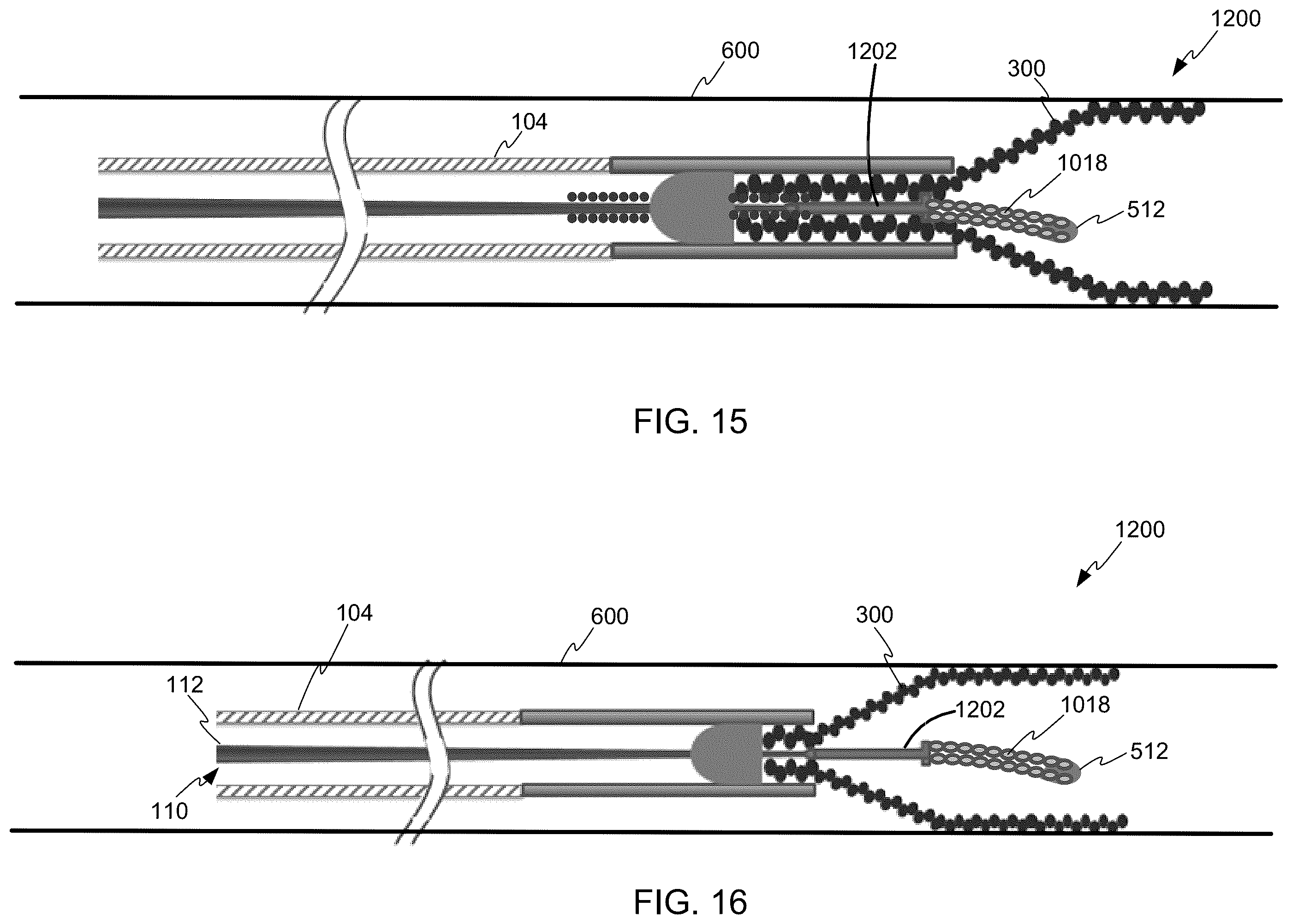 Patent US12508031 Figure 11 – Neurovascular flow diverter and delivery systems
