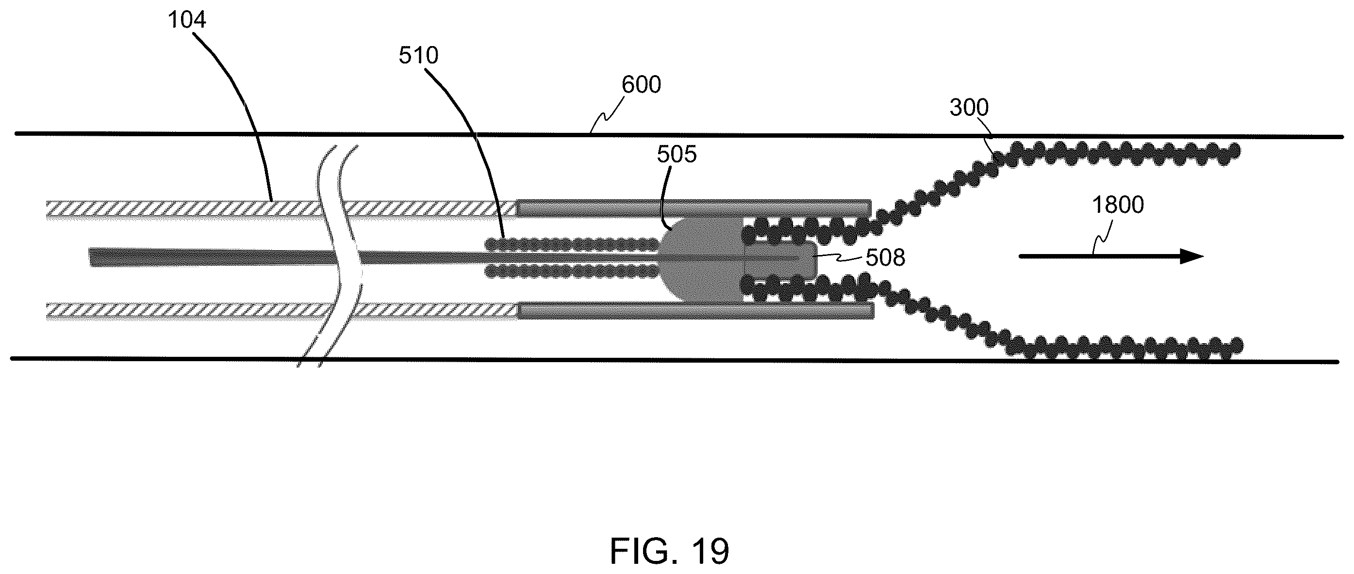 Patent US12508031 Figure 13 – Neurovascular flow diverter and delivery systems