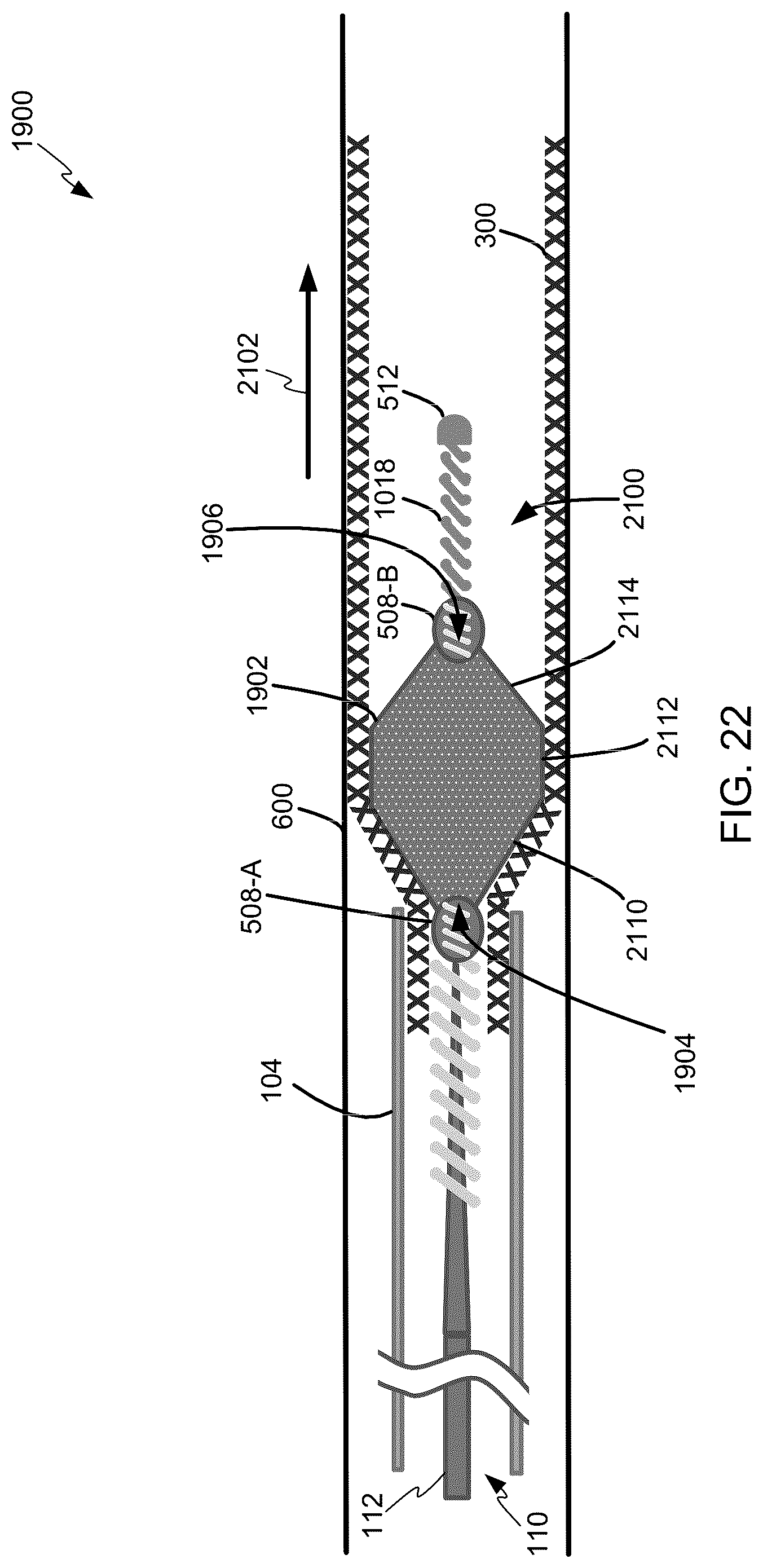 Patent US12508031 Figure 15 – Neurovascular flow diverter and delivery systems