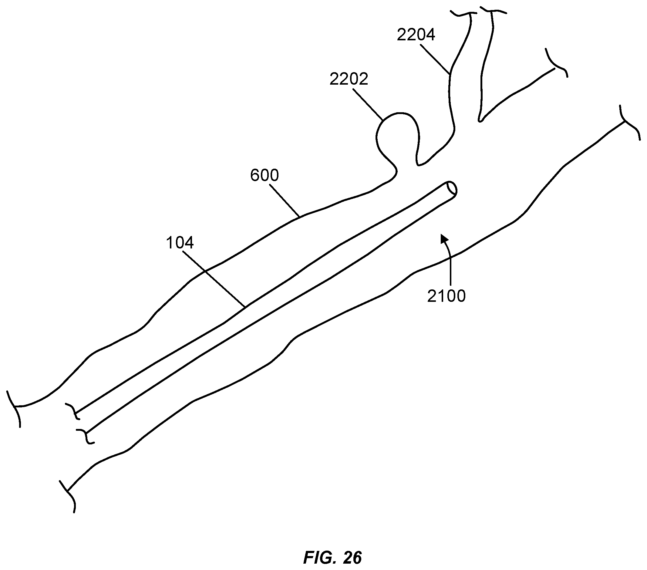 Patent US12508031 Figure 19 – Neurovascular flow diverter and delivery systems
