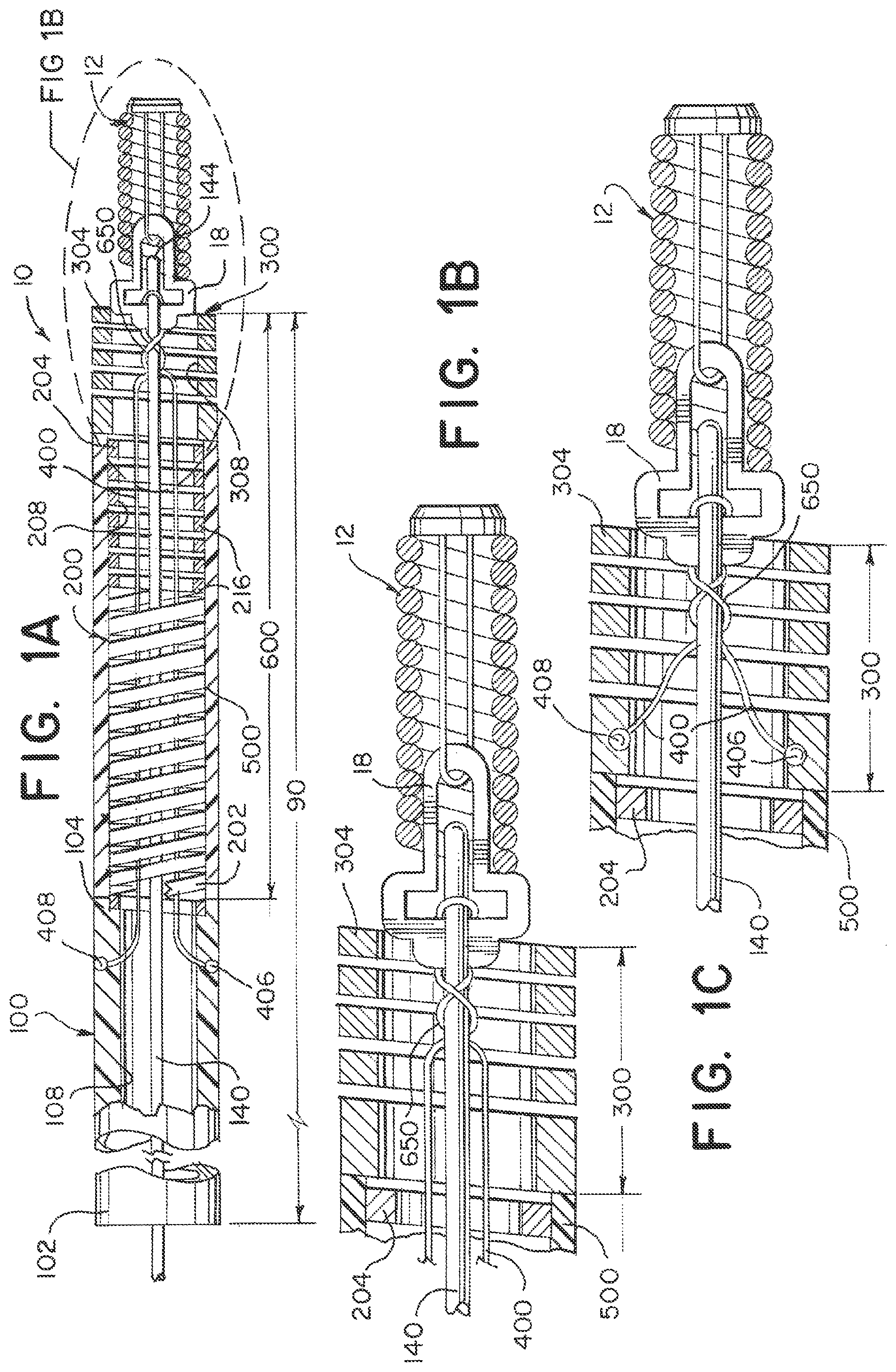Patent US12508032 Figure 1 – Medical device delivery systems with twisting loop wires