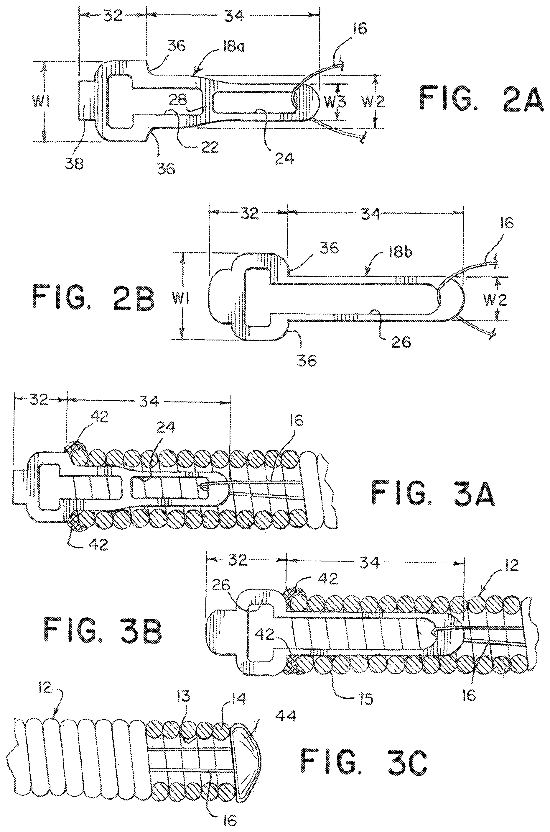 Patent US12508032 Figure 2 – Medical device delivery systems with twisting loop wires