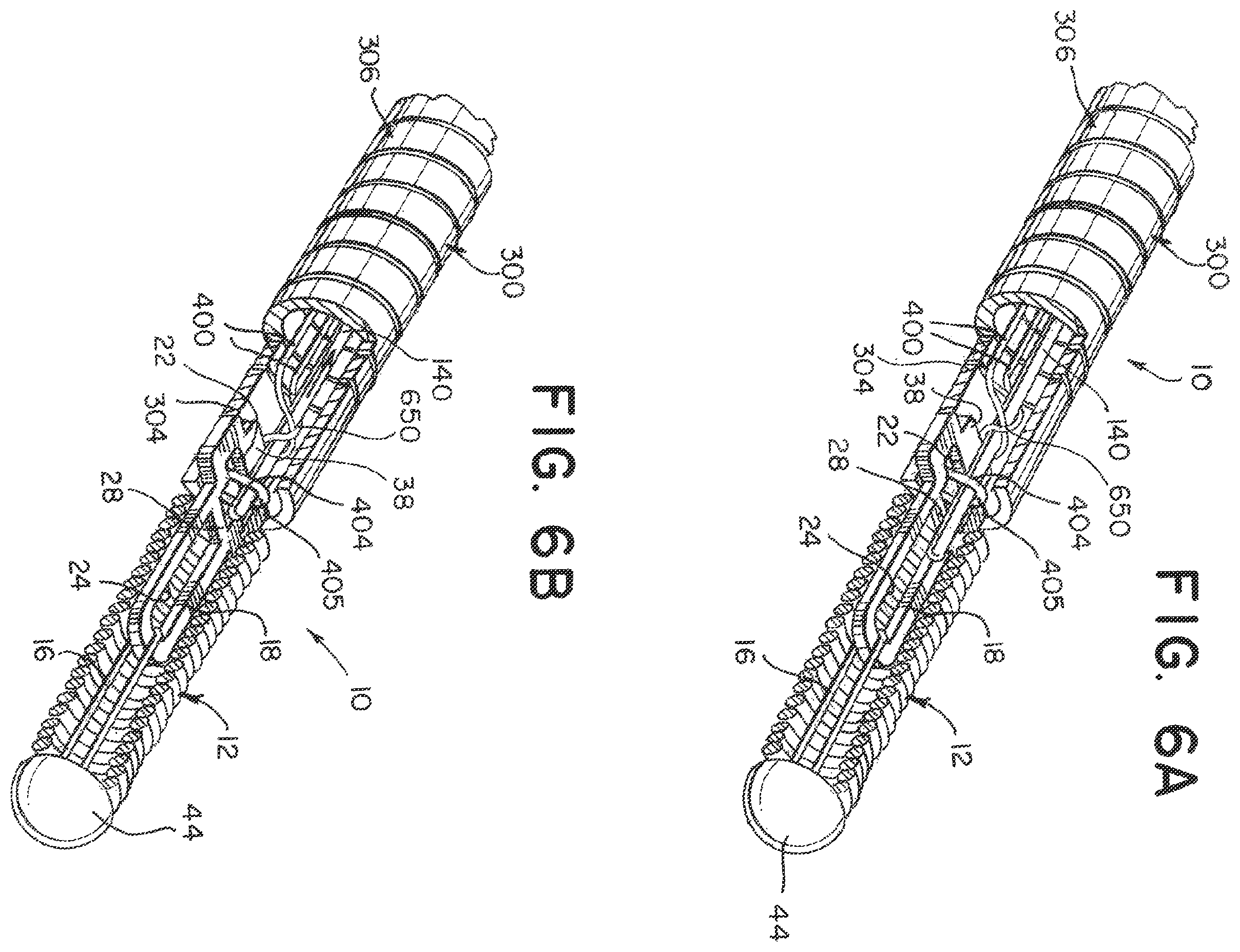 Patent US12508032 Figure 4 – Medical device delivery systems with twisting loop wires