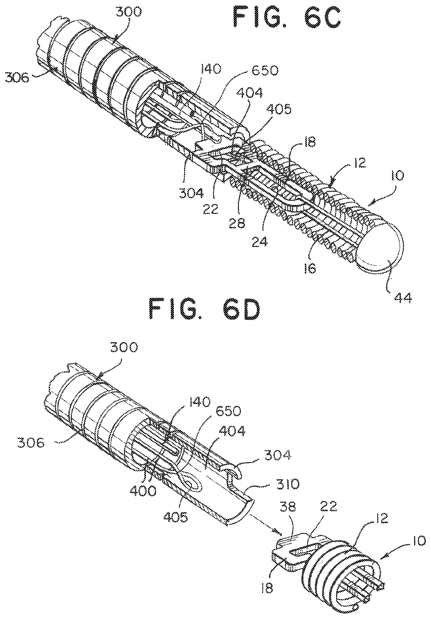 Patent US12508032 Figure 5 – Medical device delivery systems with twisting loop wires