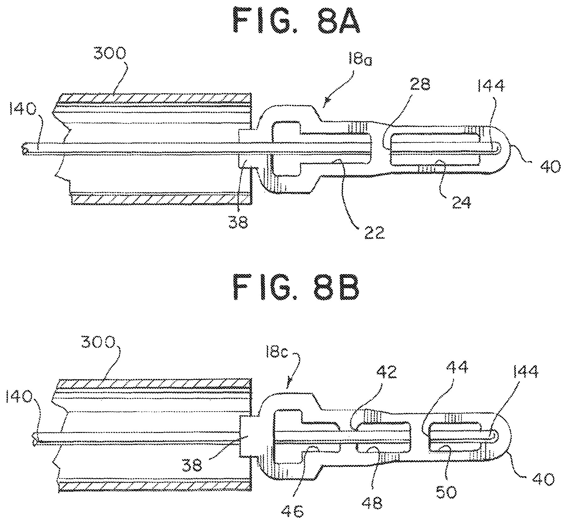 Patent US12508032 Figure 7 – Medical device delivery systems with twisting loop wires