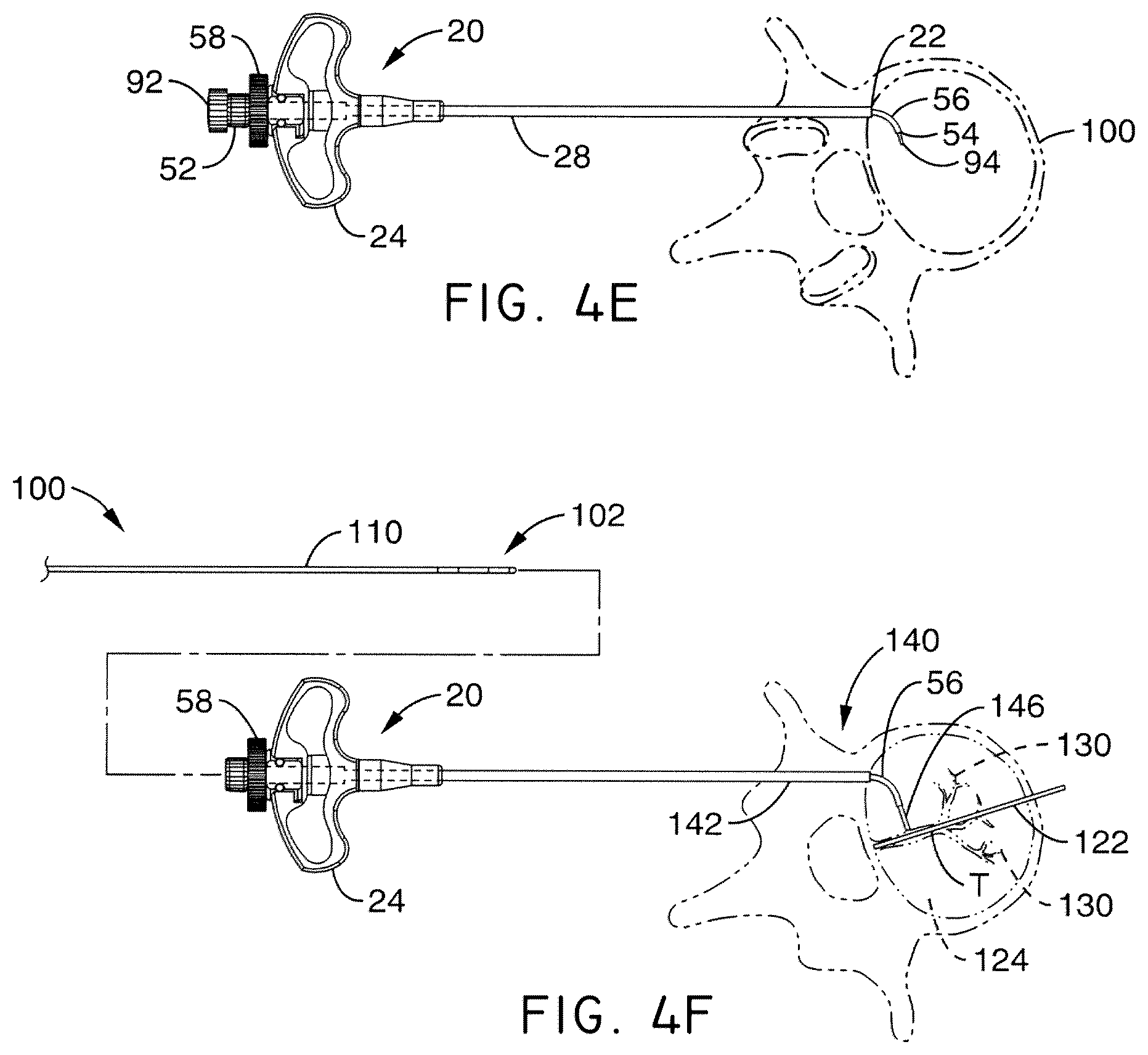 Patent US12508037 Figure 6 – Methods of navigation and treatment within a vertebral body