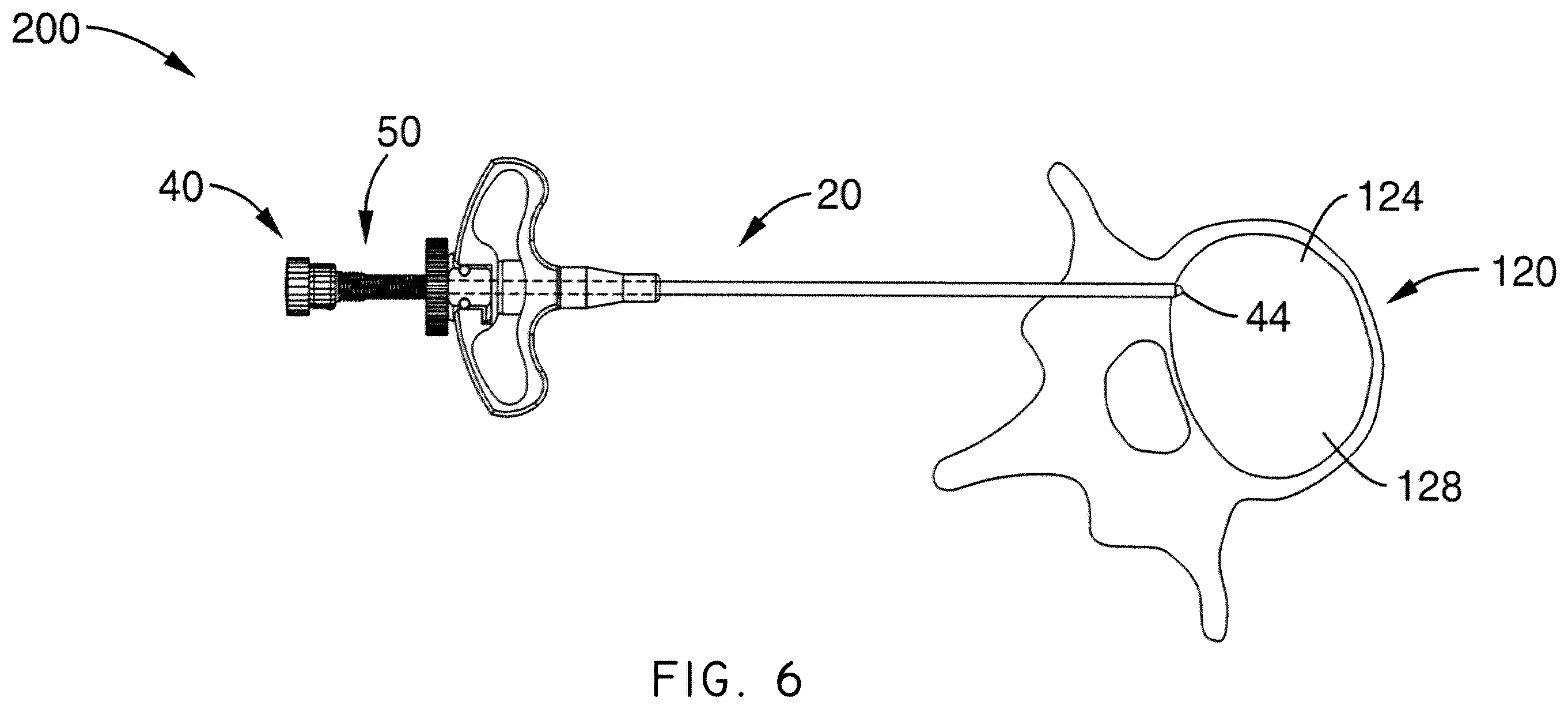Patent US12508037 Figure 8 – Methods of navigation and treatment within a vertebral body