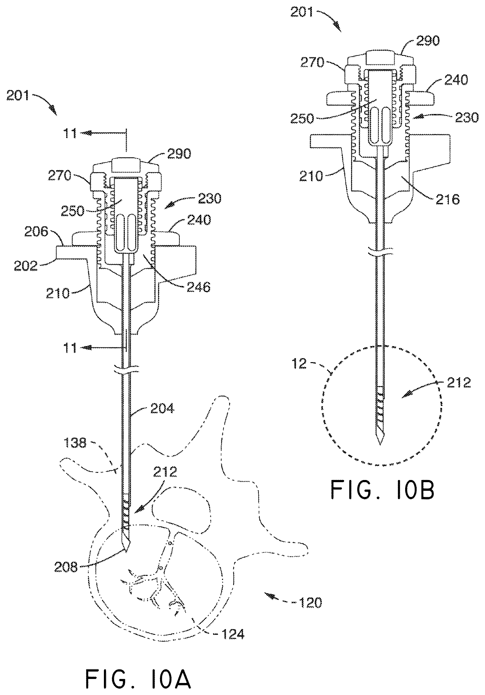 Patent US12508037 Figure 12 – Methods of navigation and treatment within a vertebral body