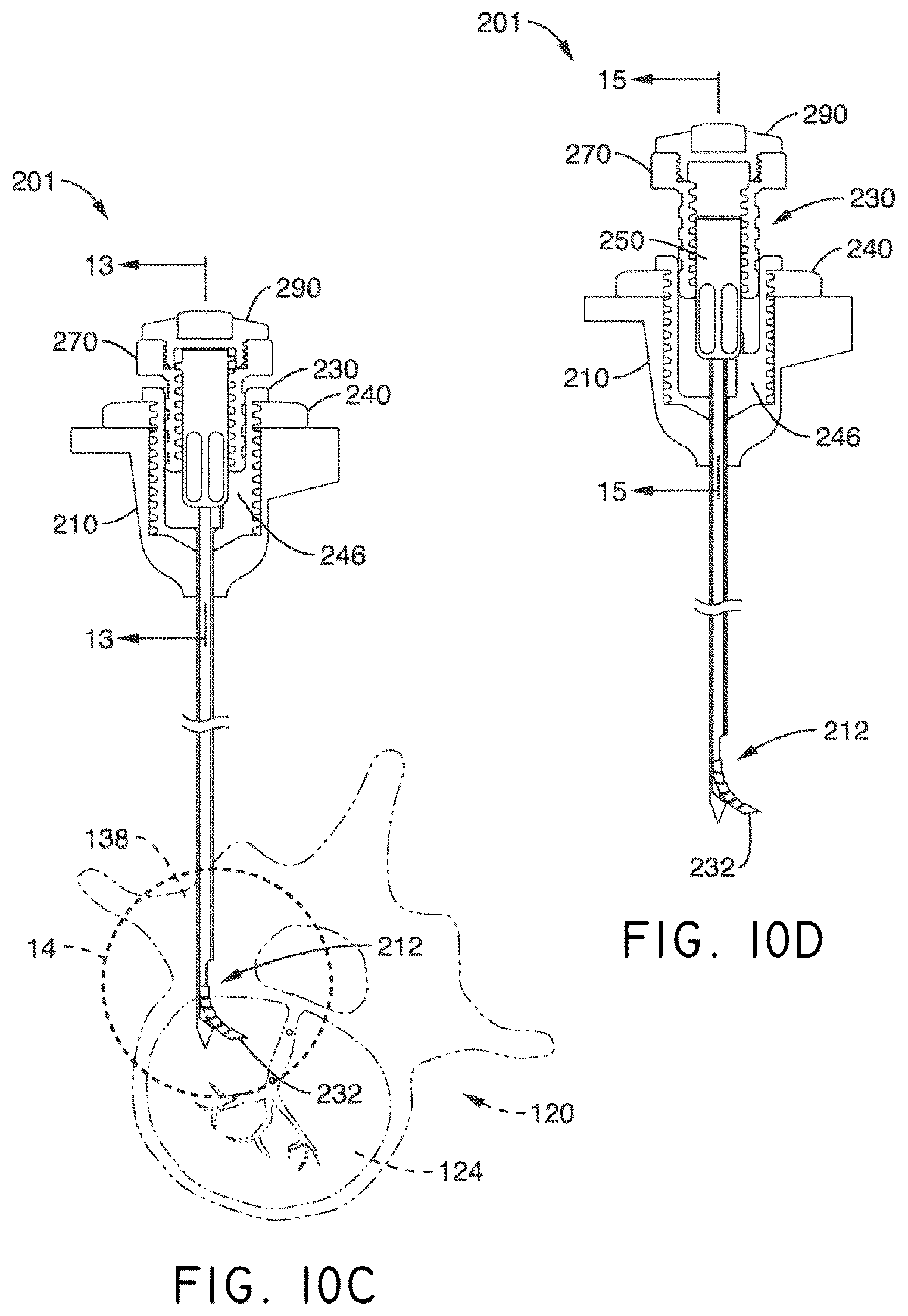 Patent US12508037 Figure 13 – Methods of navigation and treatment within a vertebral body