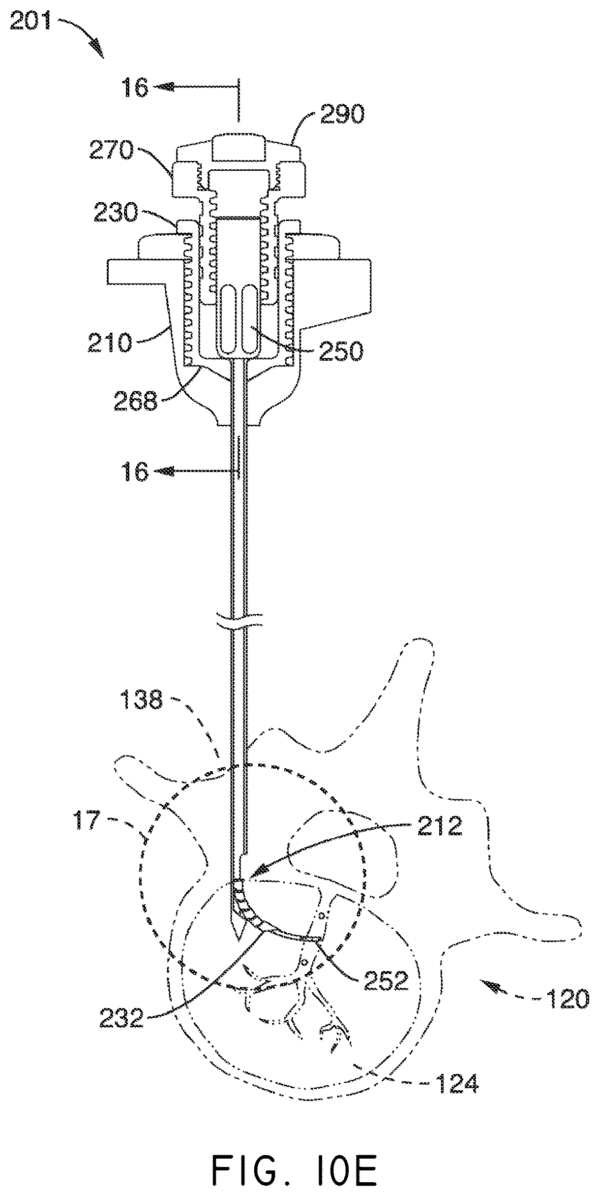 Patent US12508037 Figure 14 – Methods of navigation and treatment within a vertebral body