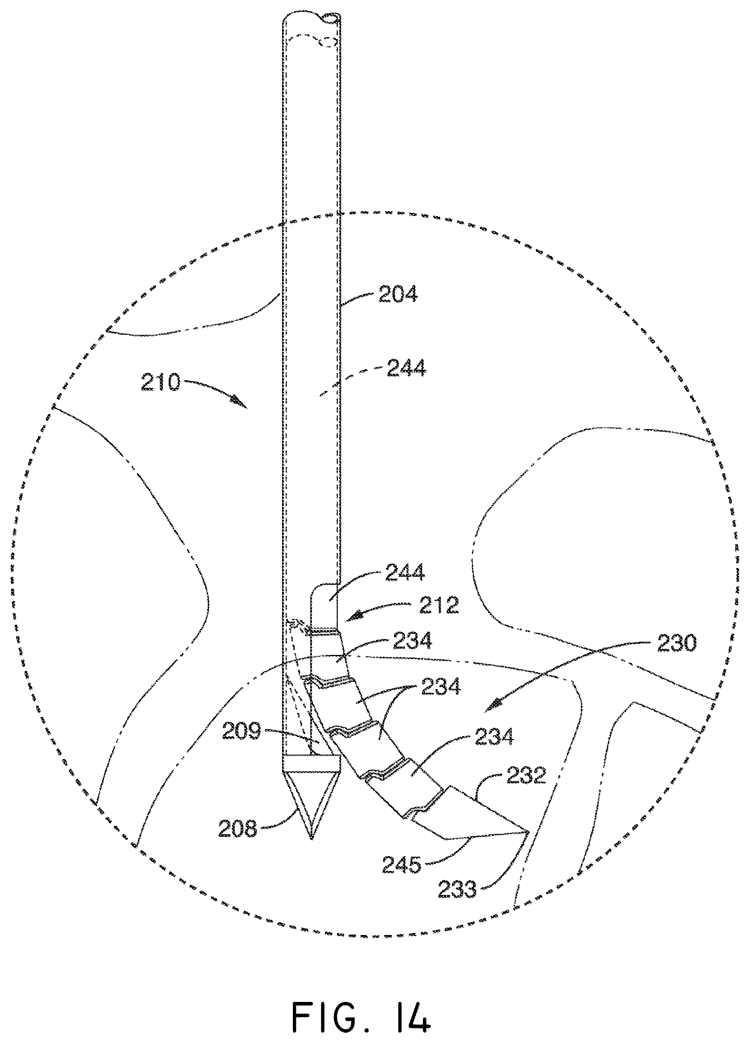 Patent US12508037 Figure 18 – Methods of navigation and treatment within a vertebral body