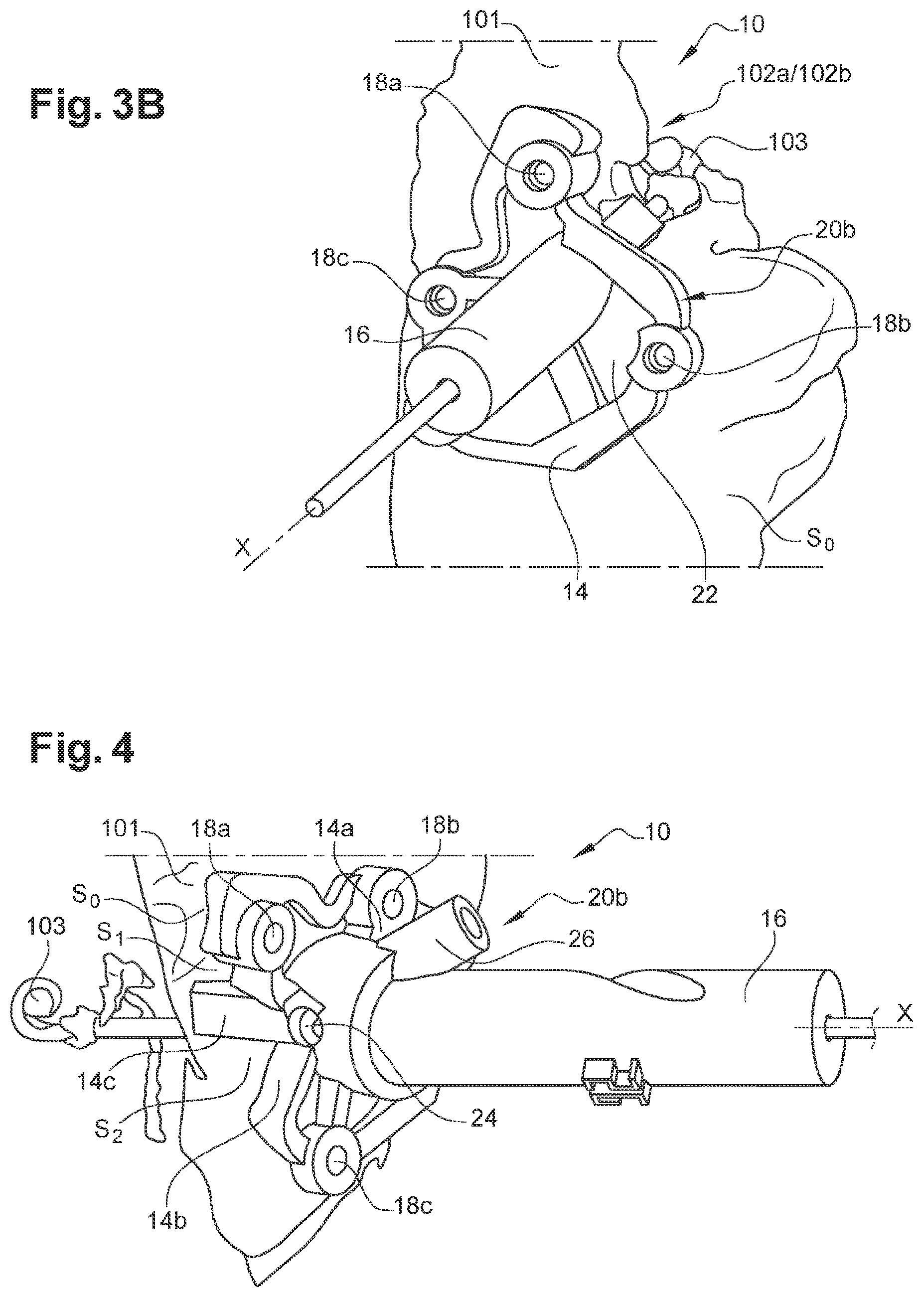 Patent US12508038 Figure 2 – Surgical insertion guide