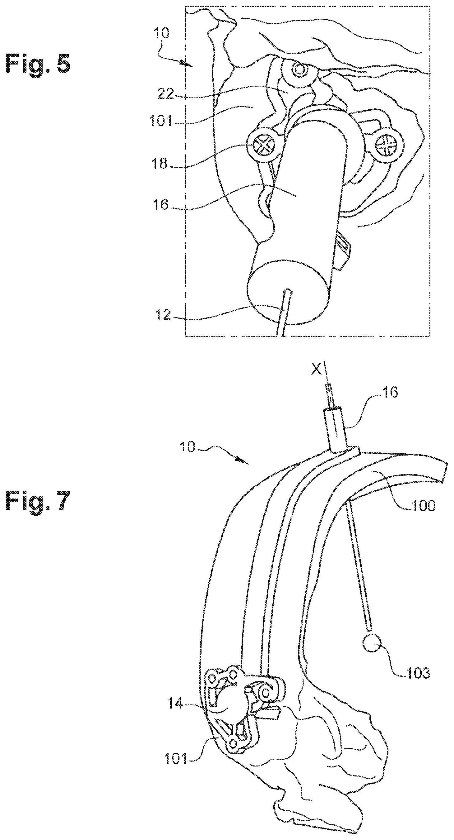 Patent US12508038 Figure 3 – Surgical insertion guide