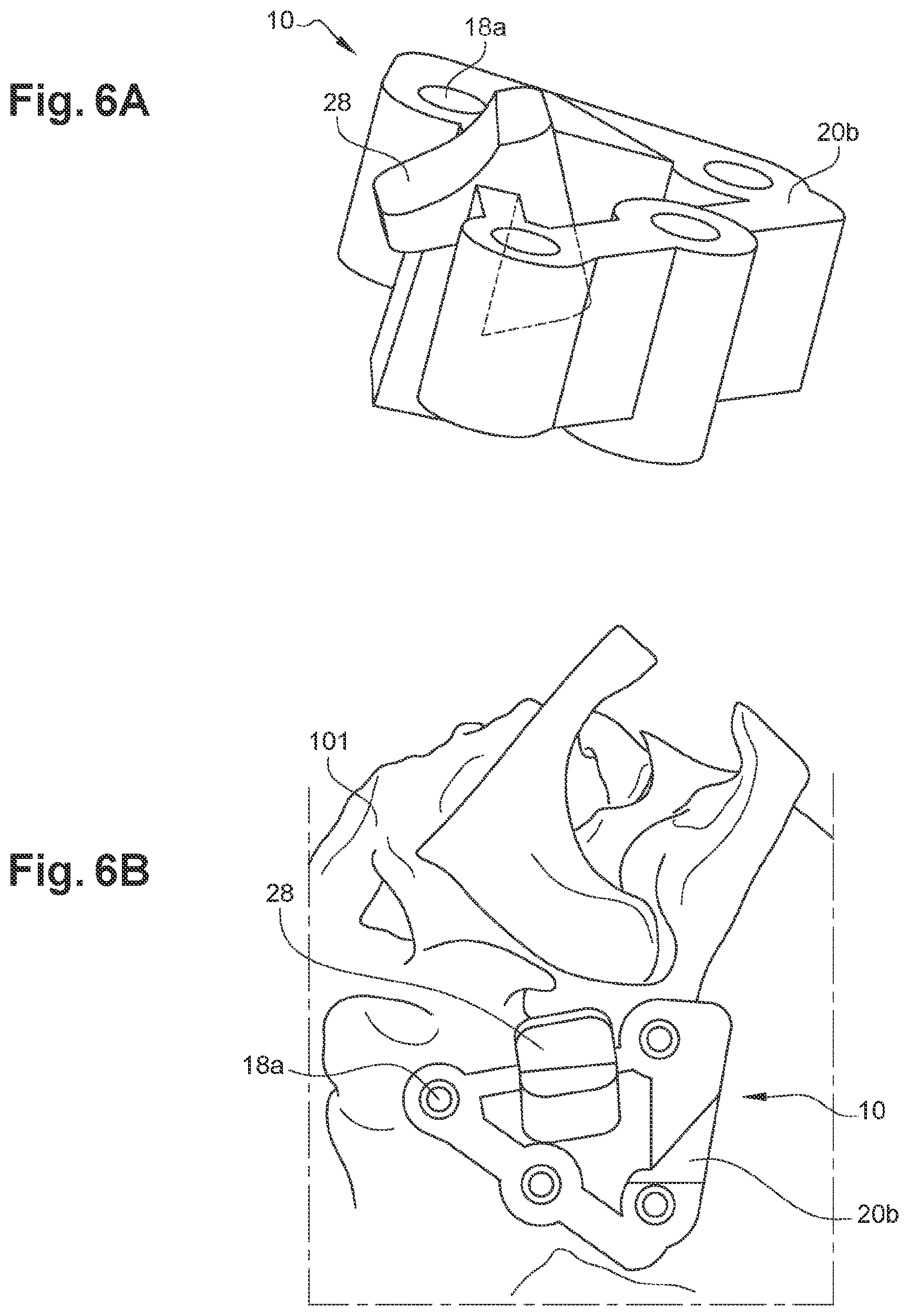 Patent US12508038 Figure 4 – Surgical insertion guide