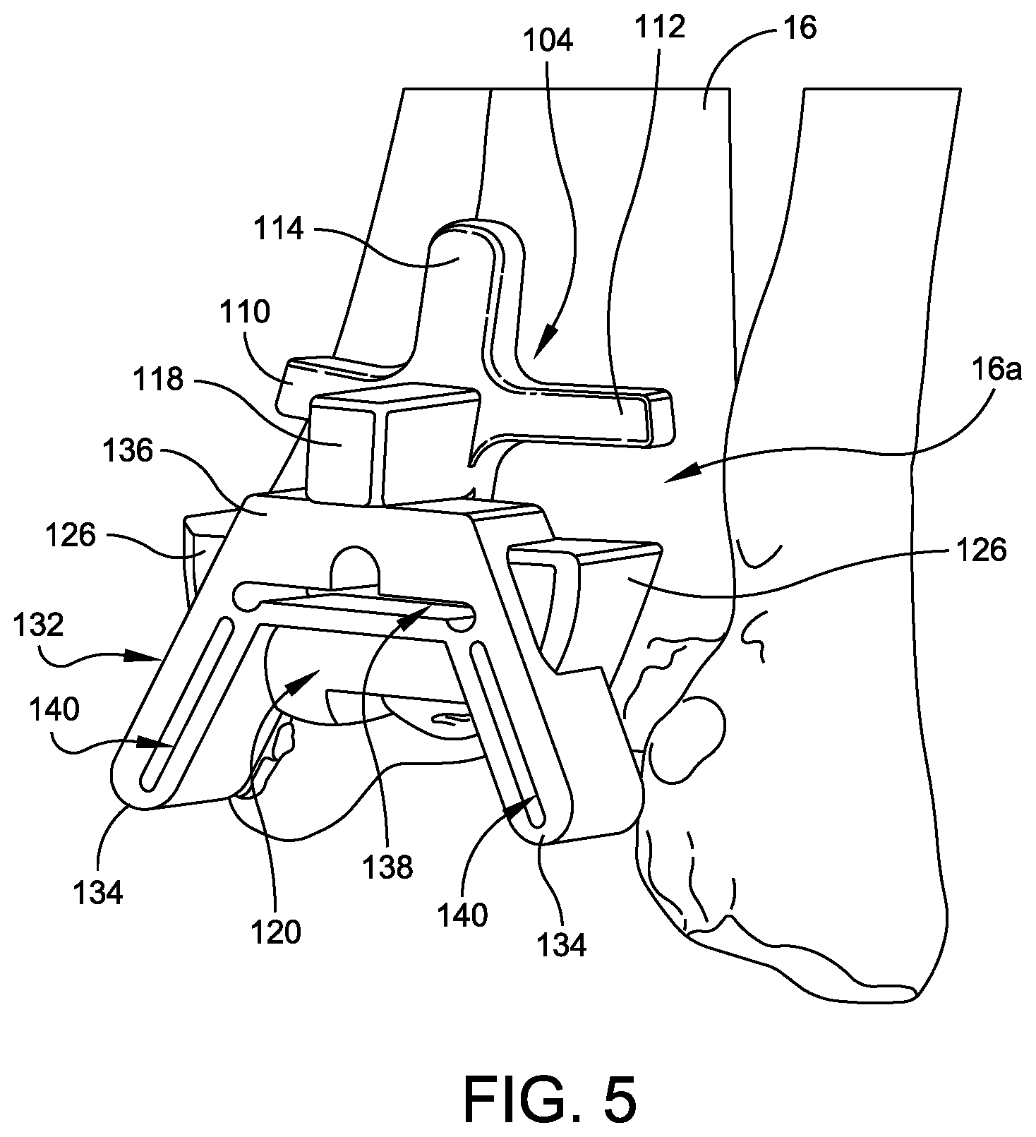 Patent US12508039 Figure 5 – Orthopedic surgical guide