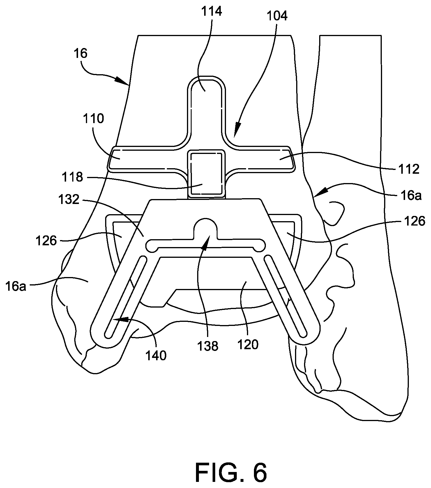 Patent US12508039 Figure 6 – Orthopedic surgical guide