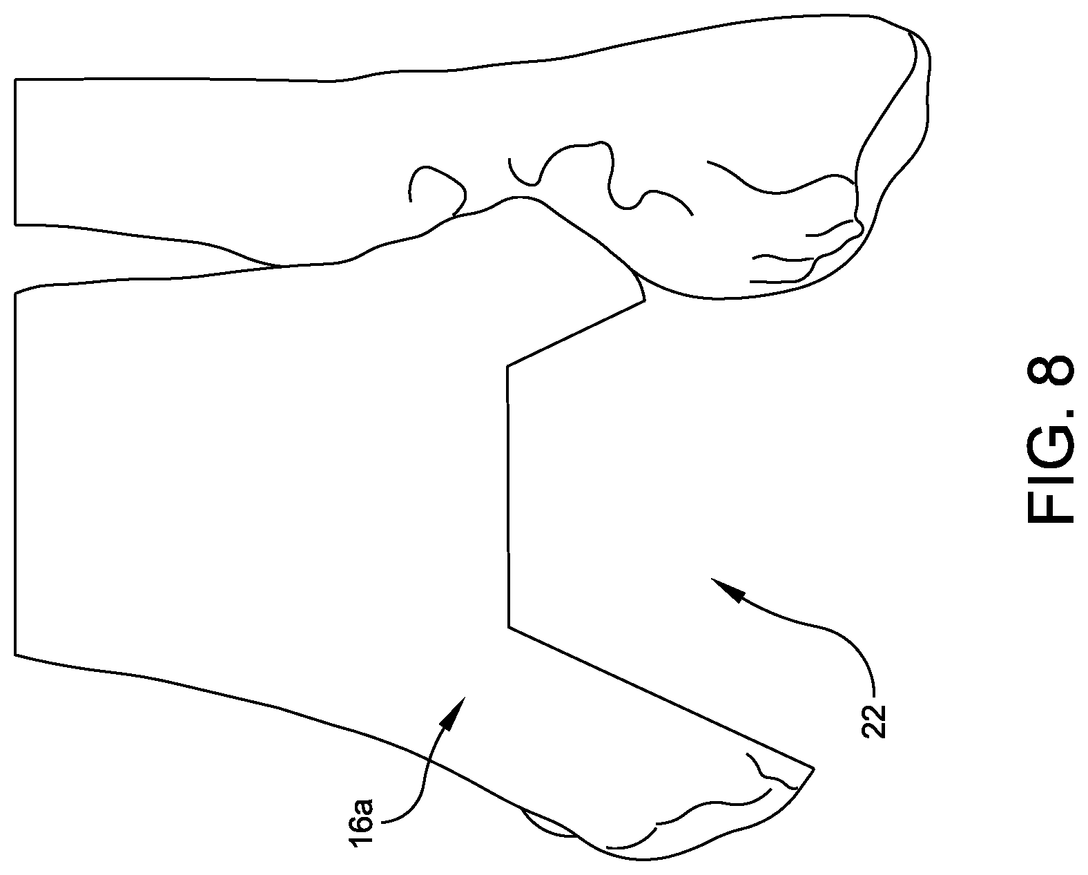 Patent US12508039 Figure 8 – Orthopedic surgical guide