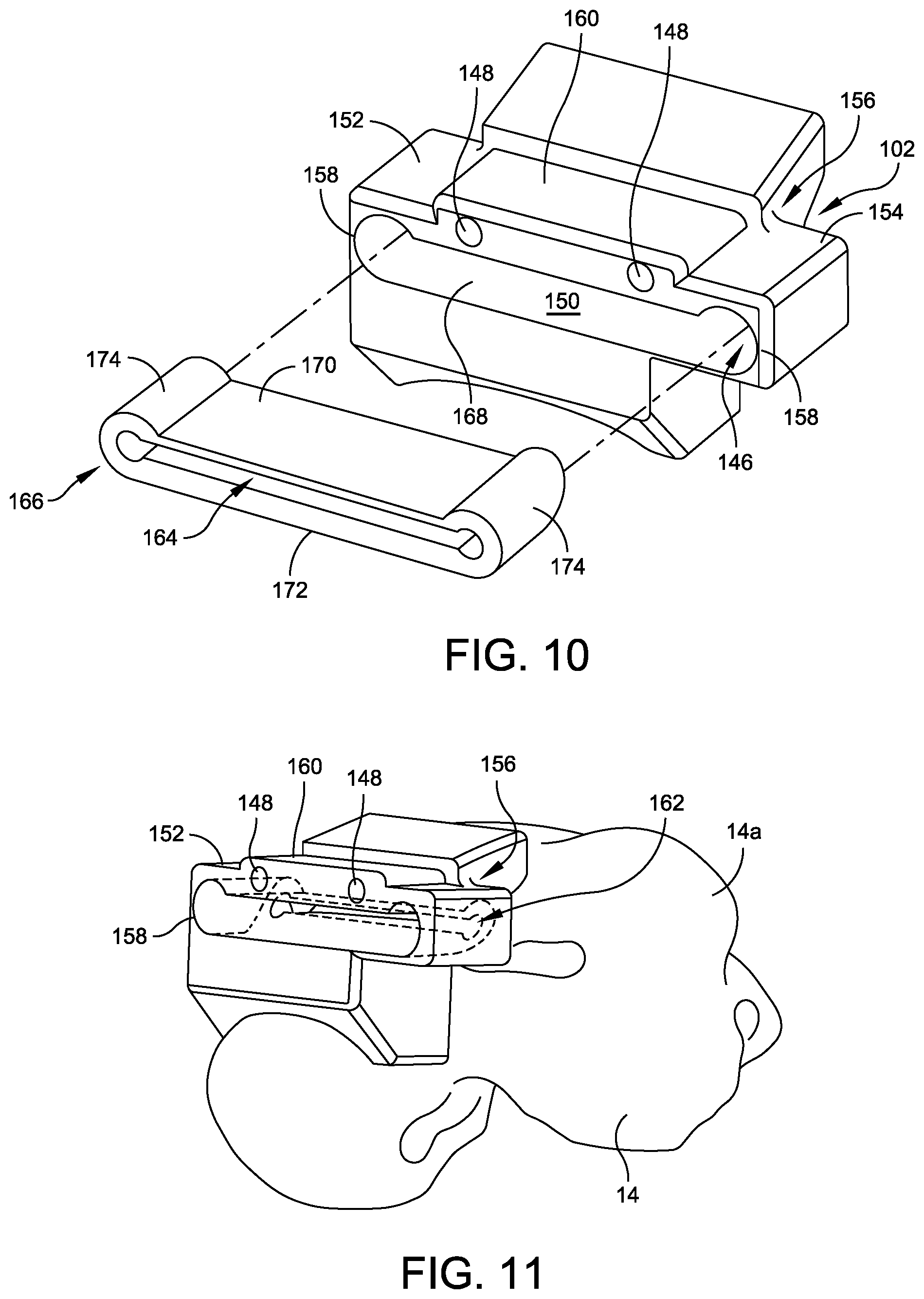 Patent US12508039 Figure 10 – Orthopedic surgical guide