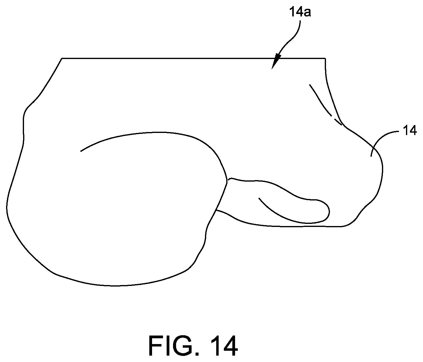 Patent US12508039 Figure 12 – Orthopedic surgical guide