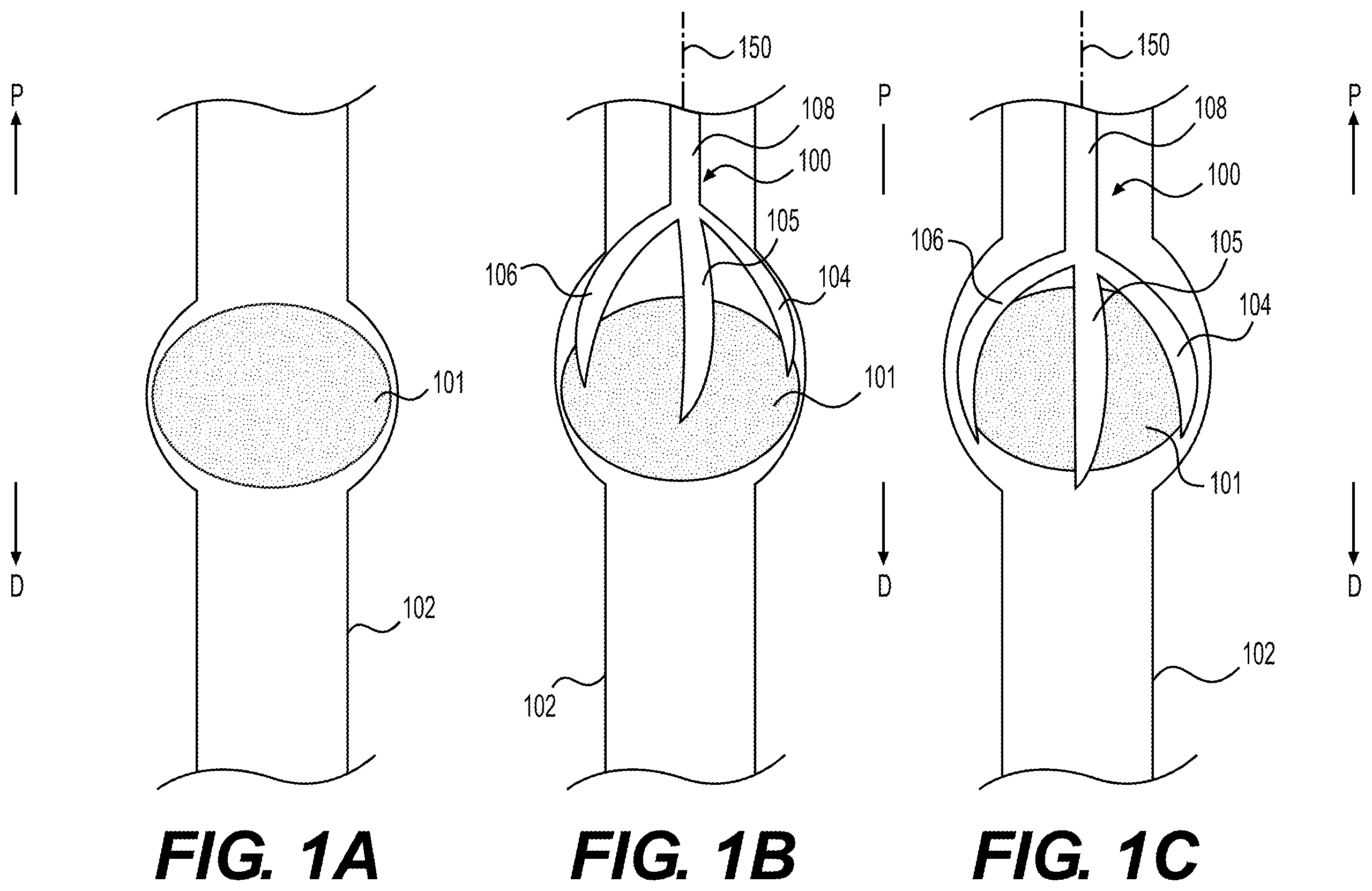Patent US12508040 Figure 1 – Medical systems, devices, and related methods