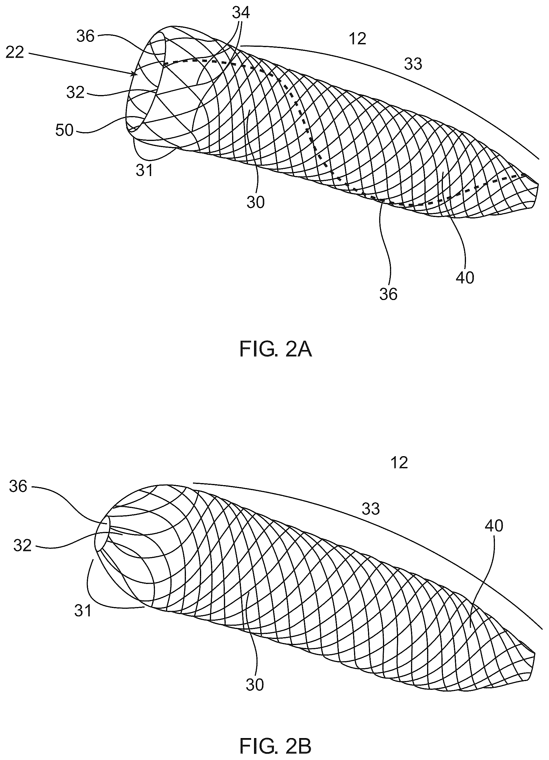 Patent US12508042 Figure 3 – Retrieval system