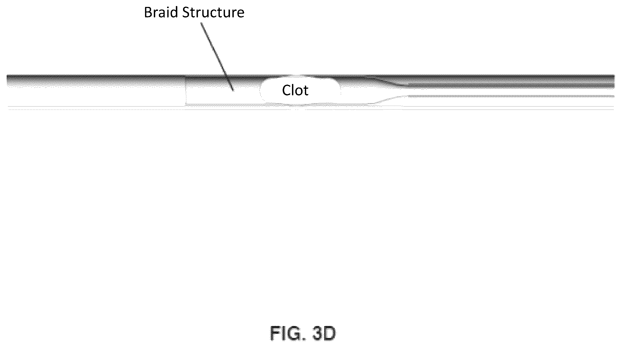 Patent US12508042 Figure 8 – Retrieval system