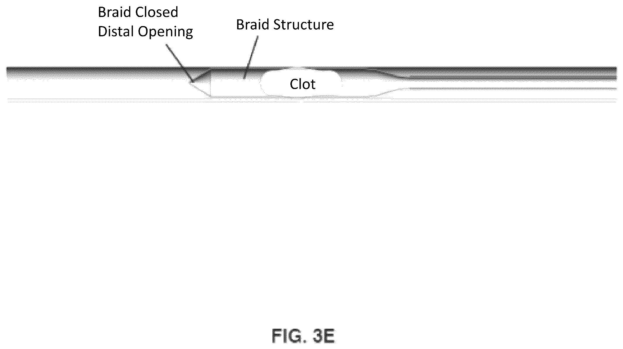 Patent US12508042 Figure 9 – Retrieval system
