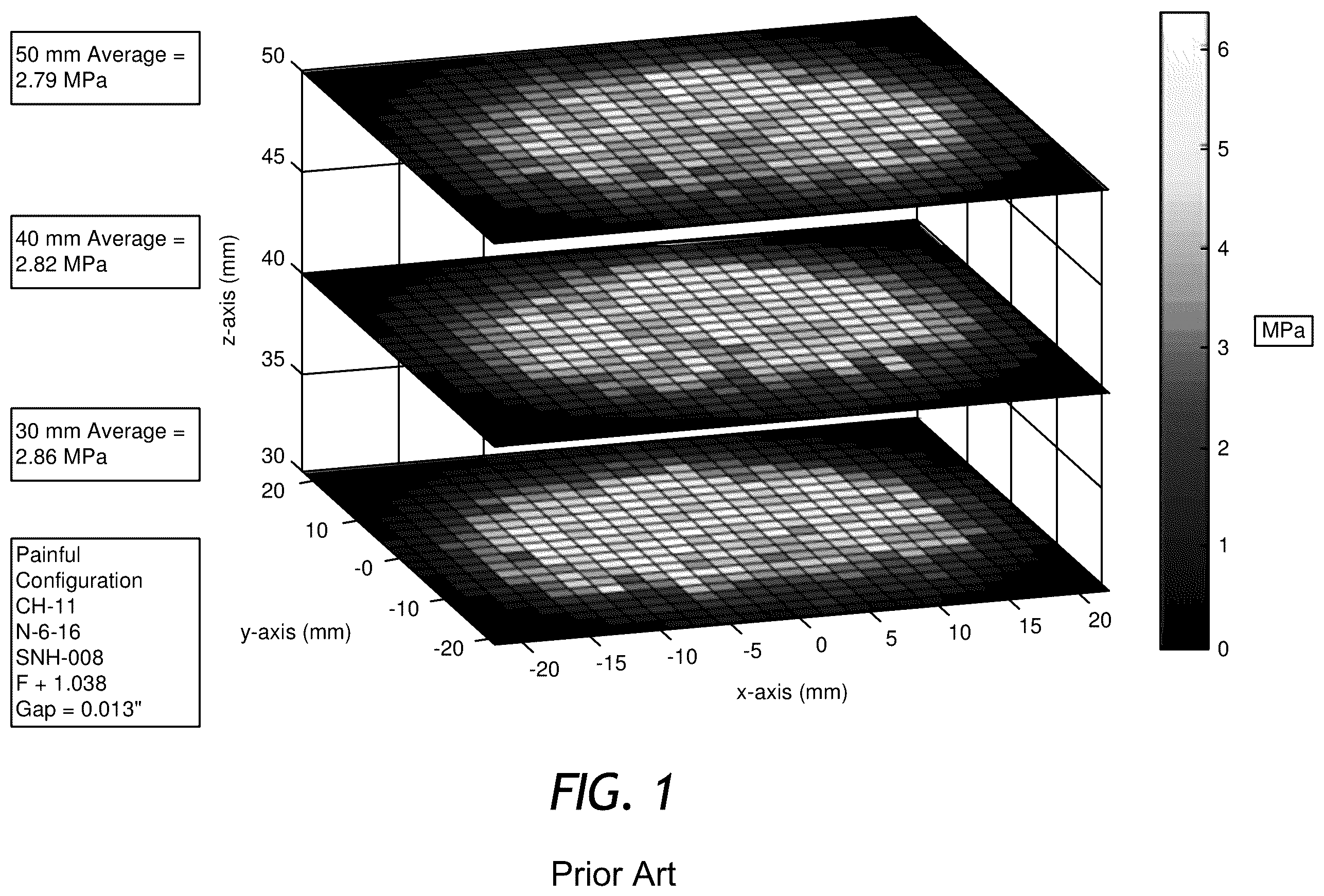 Patent US12508043 — Rapid Pulse electrohydraulic (EH) shockwave generator apparatus with improved acoustic wavefronts — Figure 1