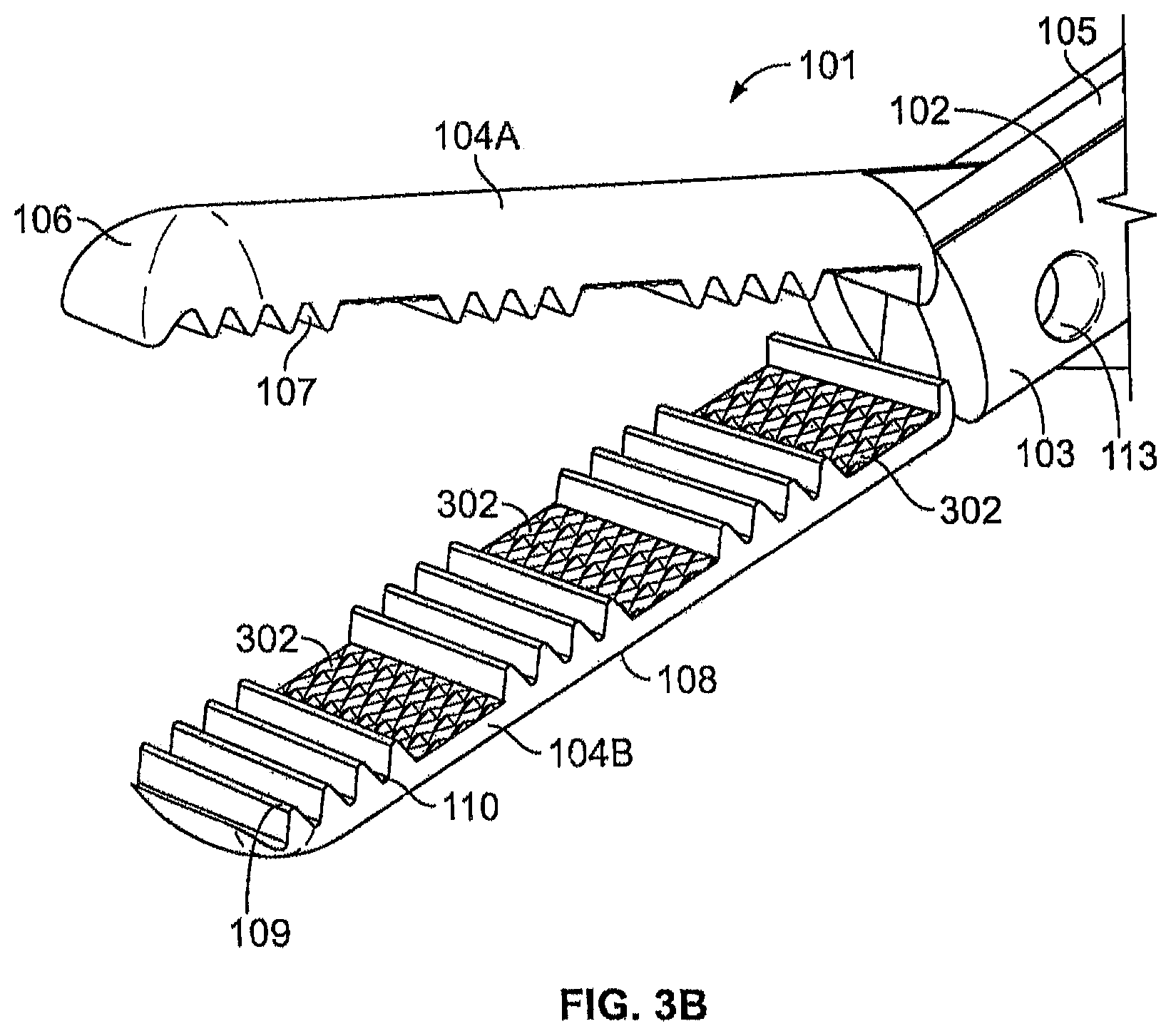 Patent US12508046 Figure 4 – Multi-functional medical device and related methods of use