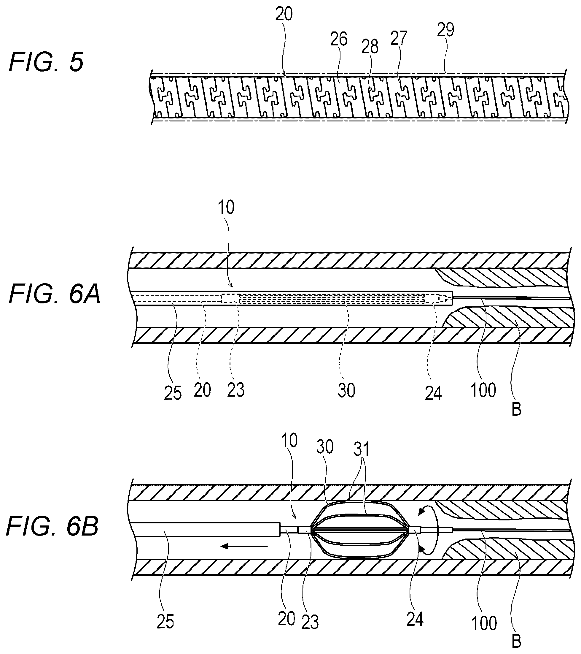 Patent US12508049 Figure 5 – Medical device and method for controlling medical device