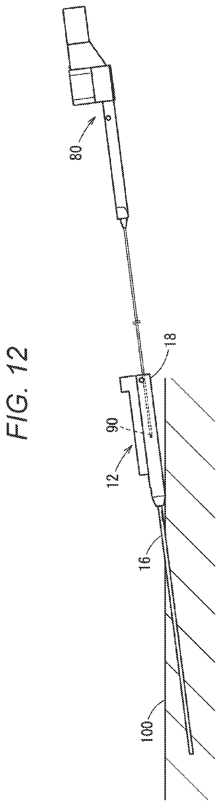 Patent US12508051 Figure 12 – Puncture needle