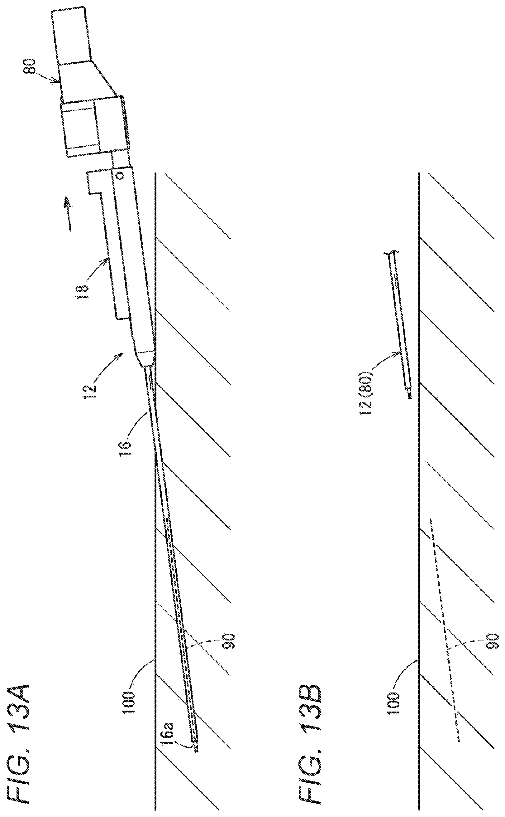 Patent US12508051 Figure 13 – Puncture needle