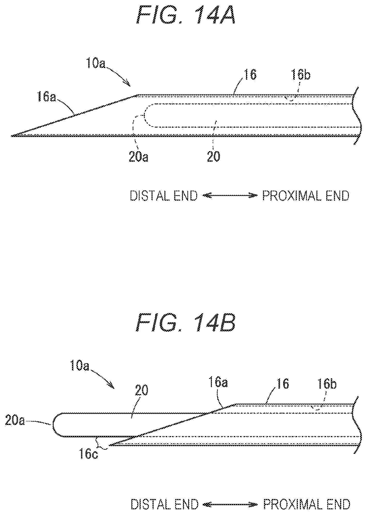 Patent US12508051 Figure 14 – Puncture needle