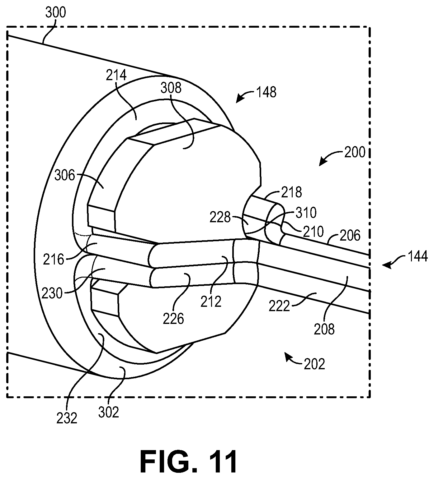 Patent US12508052 Figure 11 – Implant delivery and retrieval systems and methods