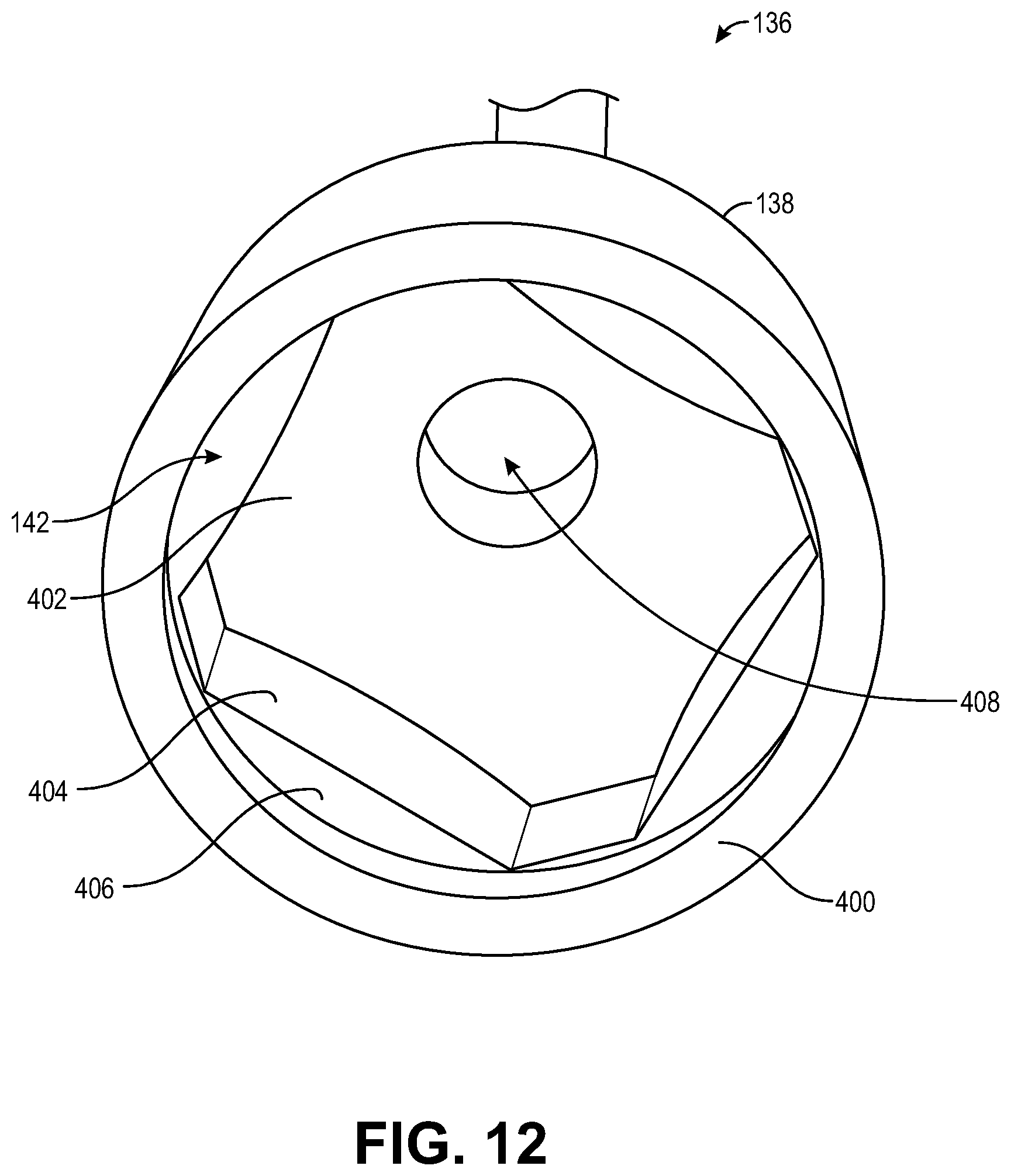 Patent US12508052 Figure 12 – Implant delivery and retrieval systems and methods