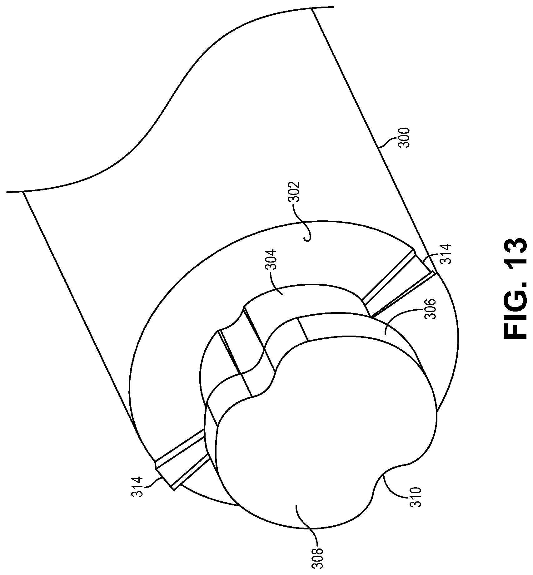 Patent US12508052 Figure 13 – Implant delivery and retrieval systems and methods