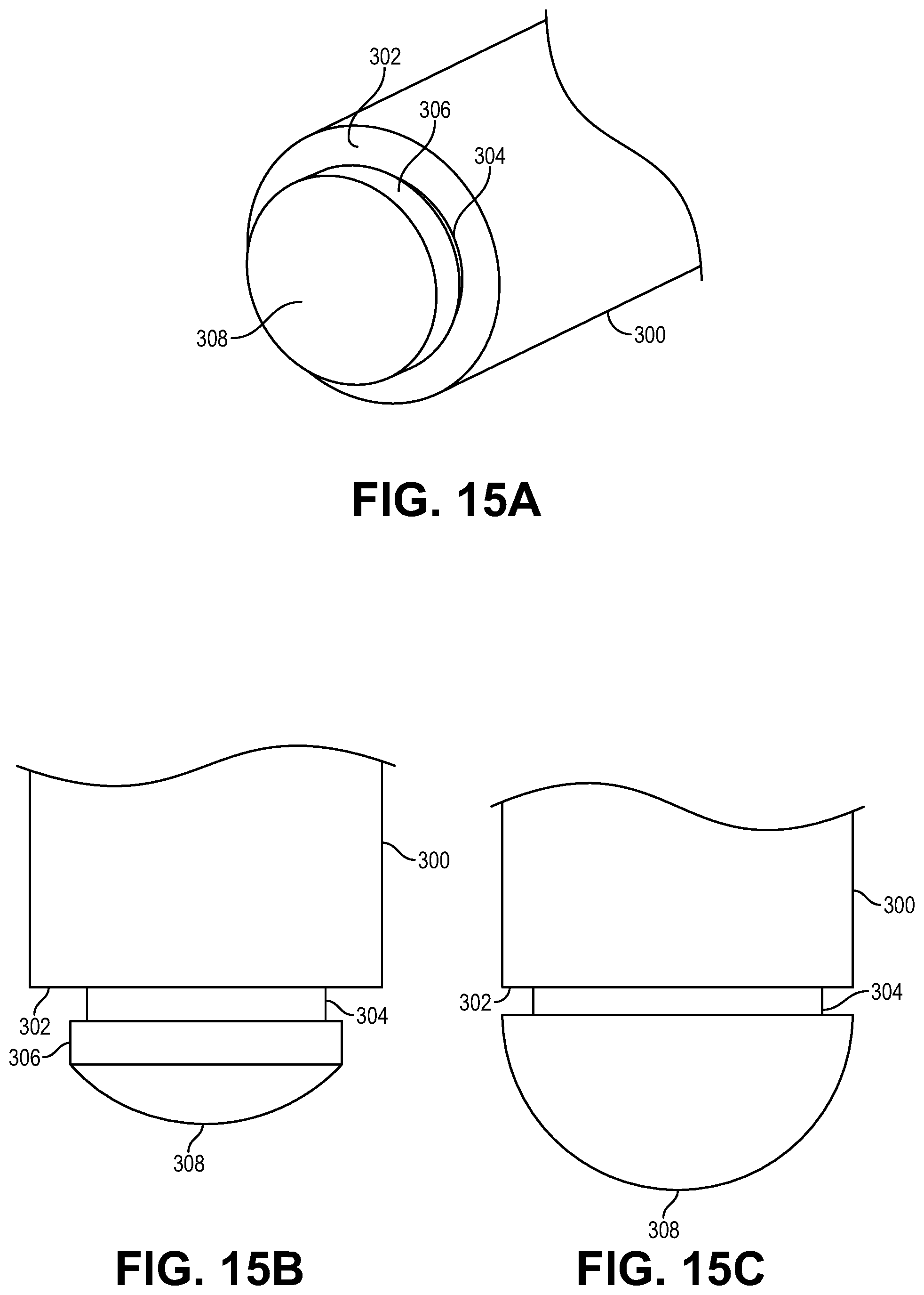 Patent US12508052 Figure 15 – Implant delivery and retrieval systems and methods