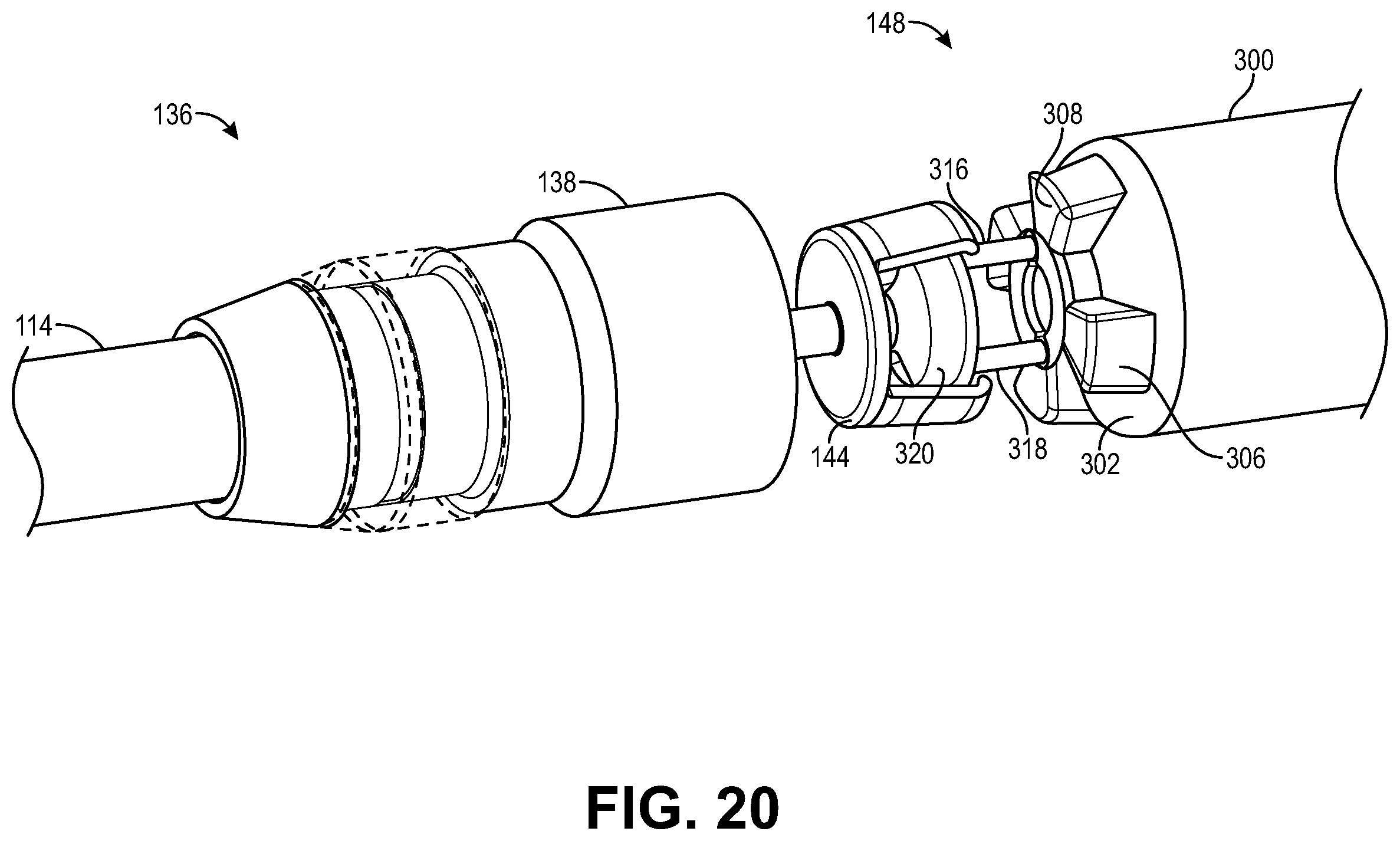 Patent US12508052 Figure 20 – Implant delivery and retrieval systems and methods