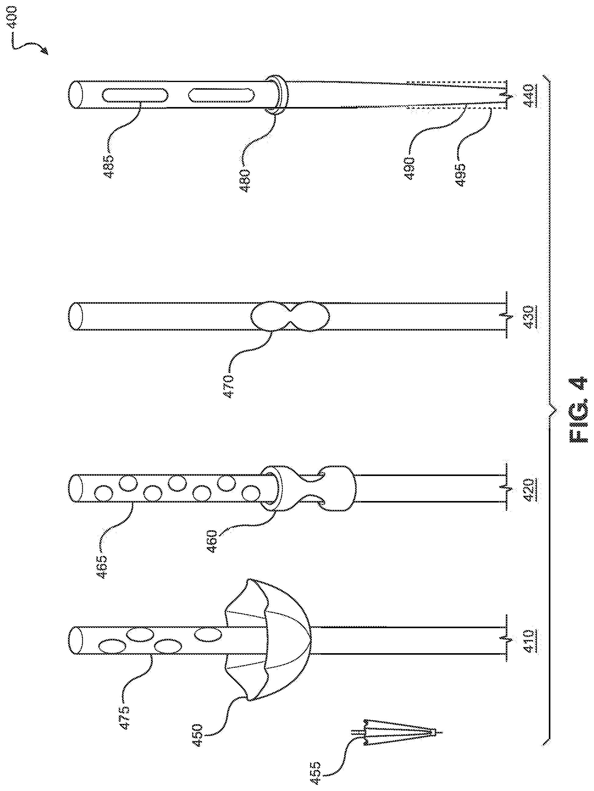 Patent US12508053 Figure 4 – Systems, devices, and methods for uterine hemostasis