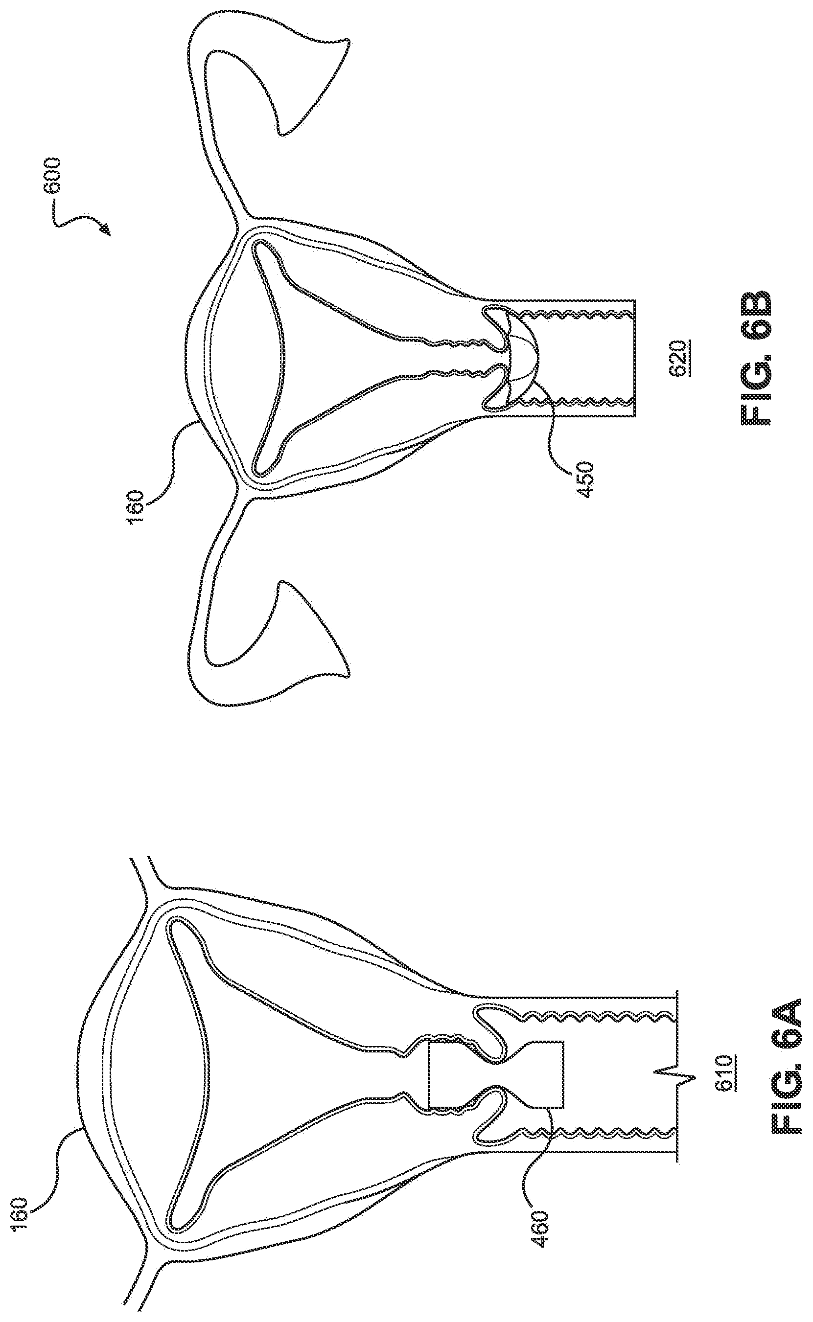 Patent US12508053 Figure 6 – Systems, devices, and methods for uterine hemostasis