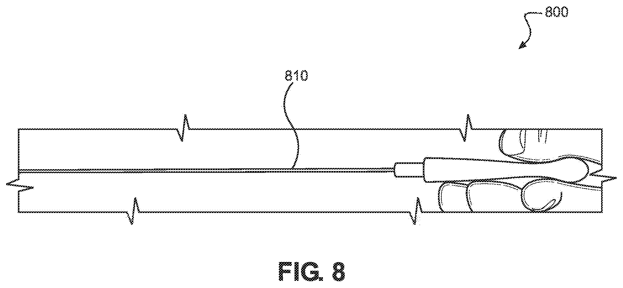 Patent US12508053 Figure 8 – Systems, devices, and methods for uterine hemostasis