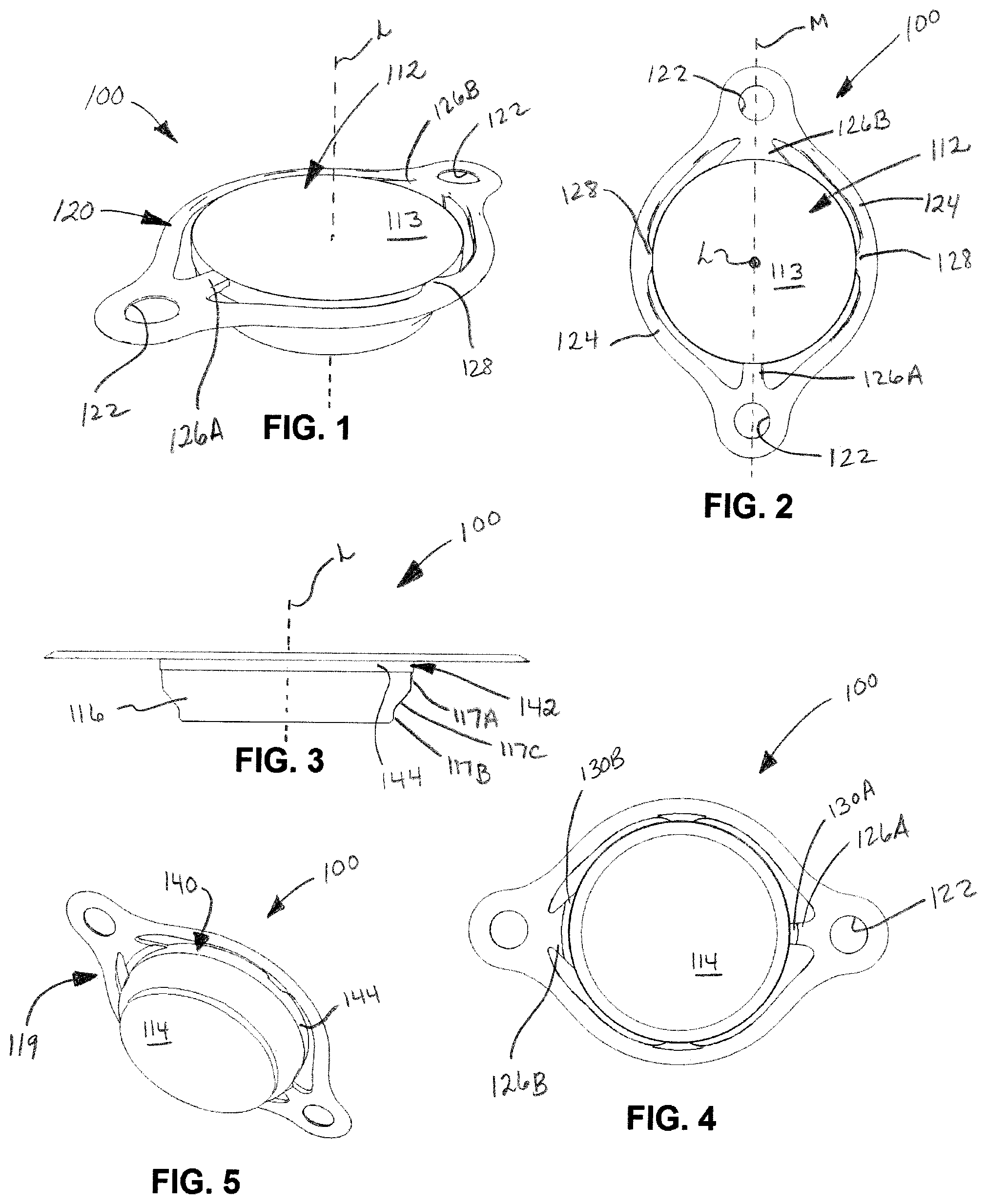 Patent US12508054 — Implants for filling bore holes in bone and methods for filling bore holes in bone — Figure 1