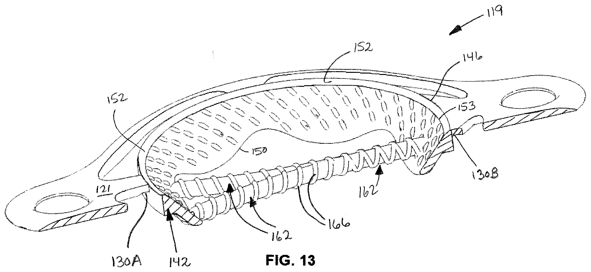 Patent US12508054 Figure 5 – Implants for filling bore holes in bone and methods for filling bore holes in bone