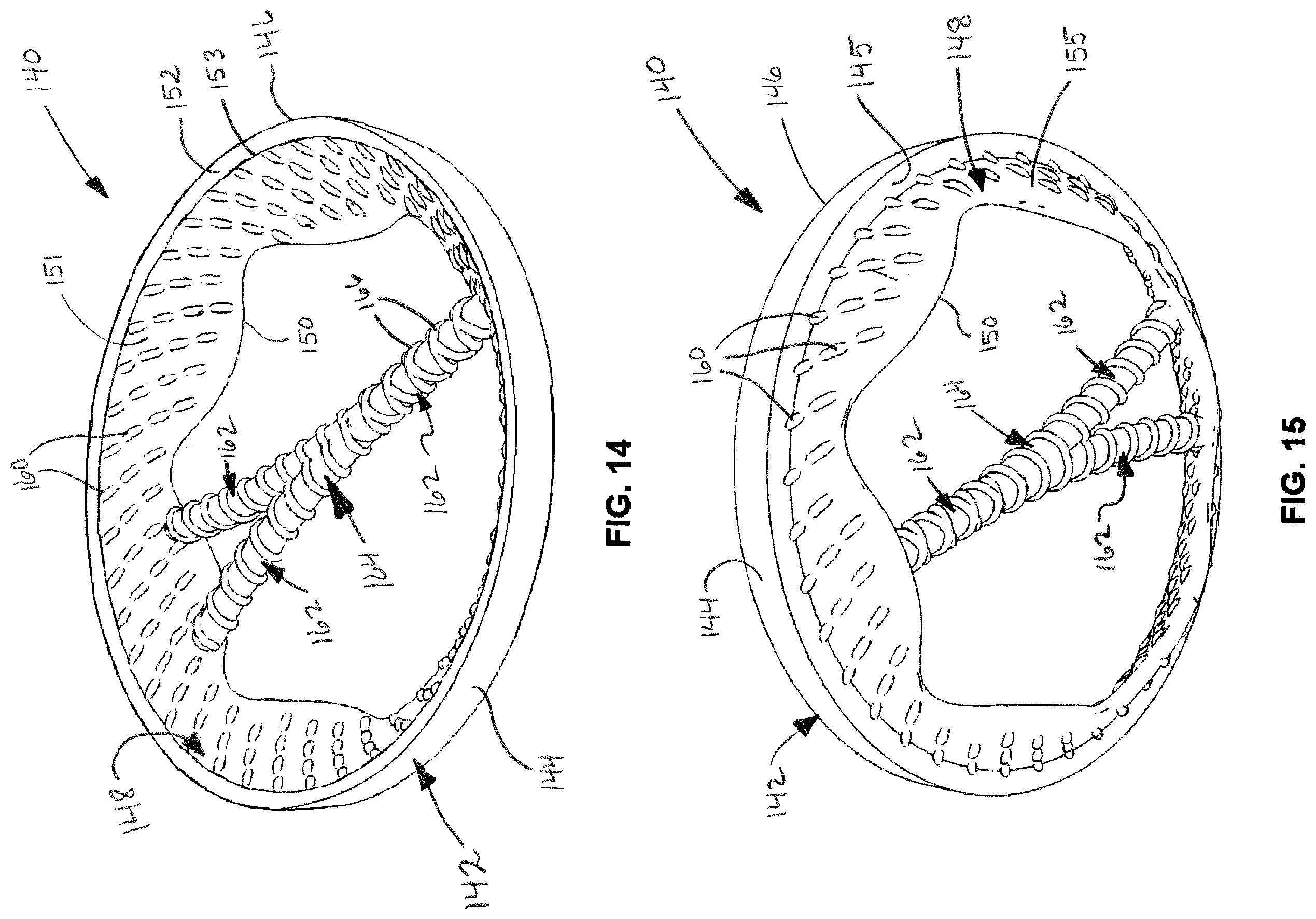 Patent US12508054 Figure 6 – Implants for filling bore holes in bone and methods for filling bore holes in bone