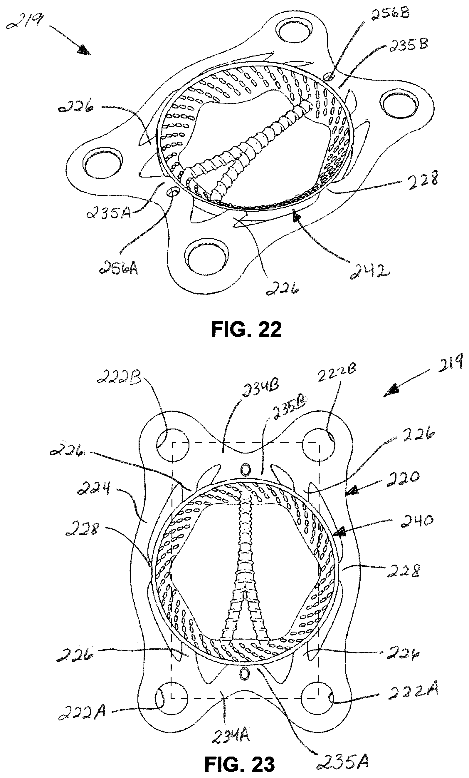 Patent US12508054 Figure 9 – Implants for filling bore holes in bone and methods for filling bore holes in bone